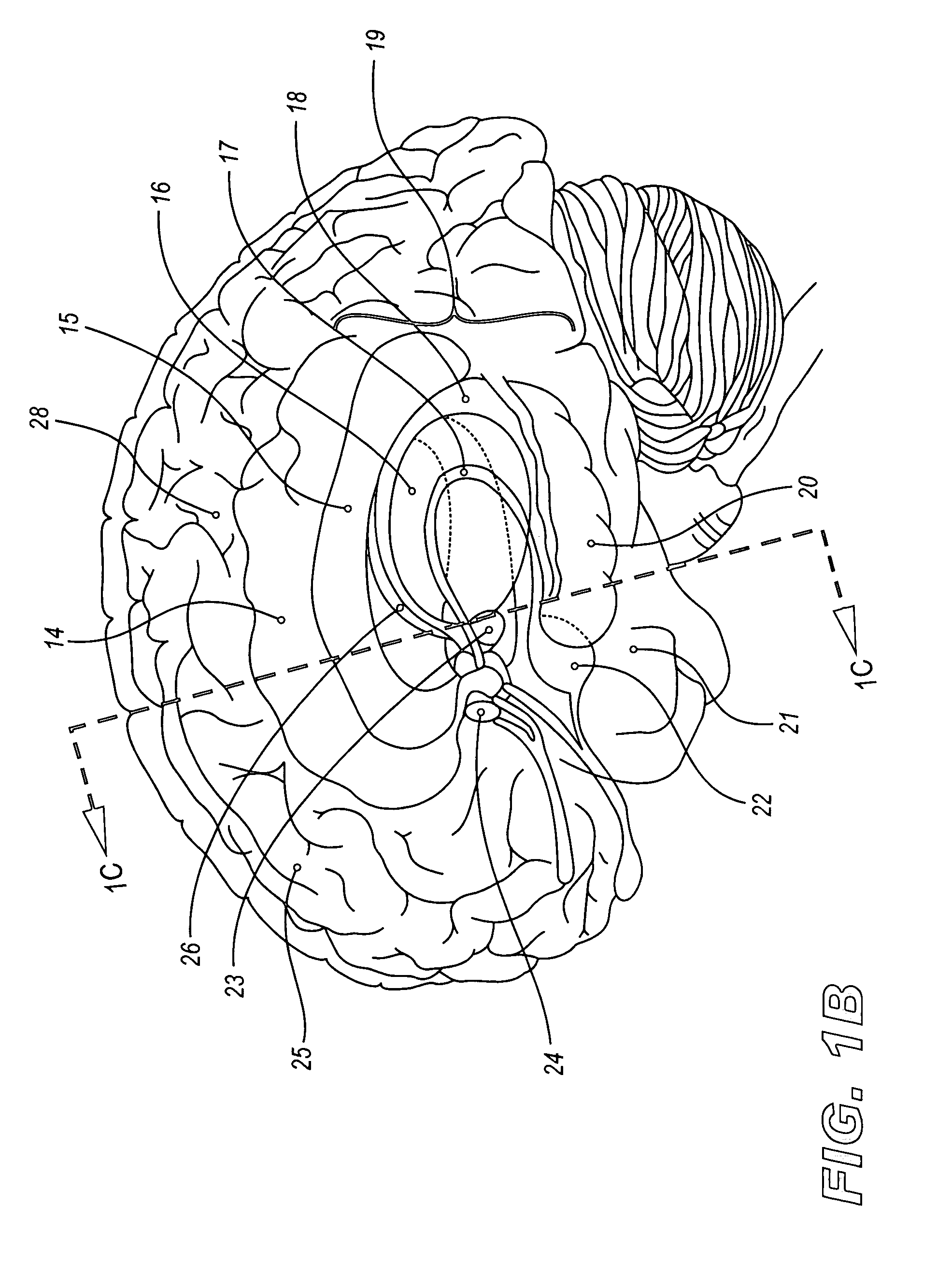 Methods and systems for treating autism