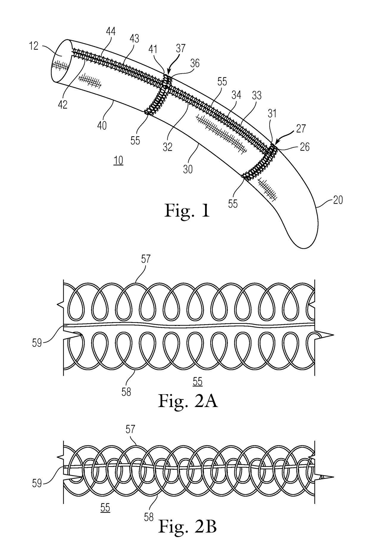 Drapes with circumferential and longitudinal breakaways