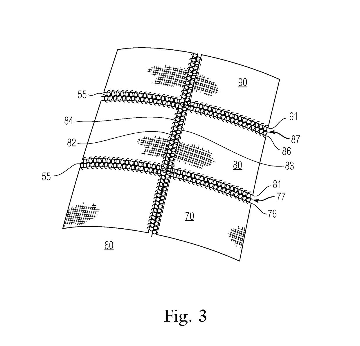 Drapes with circumferential and longitudinal breakaways