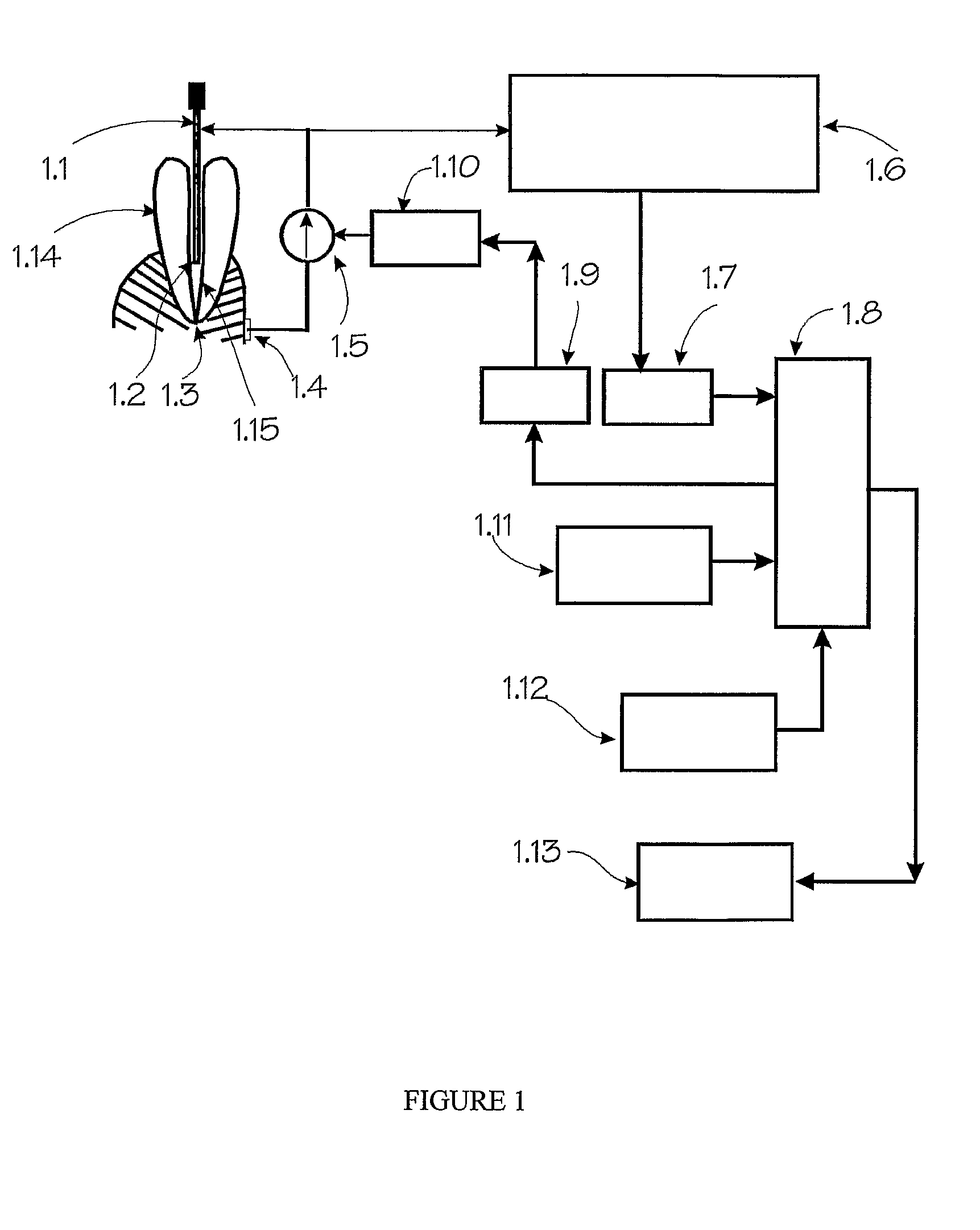 Radicular spectral attenuation coefficient for use in endodontic foraminal locator