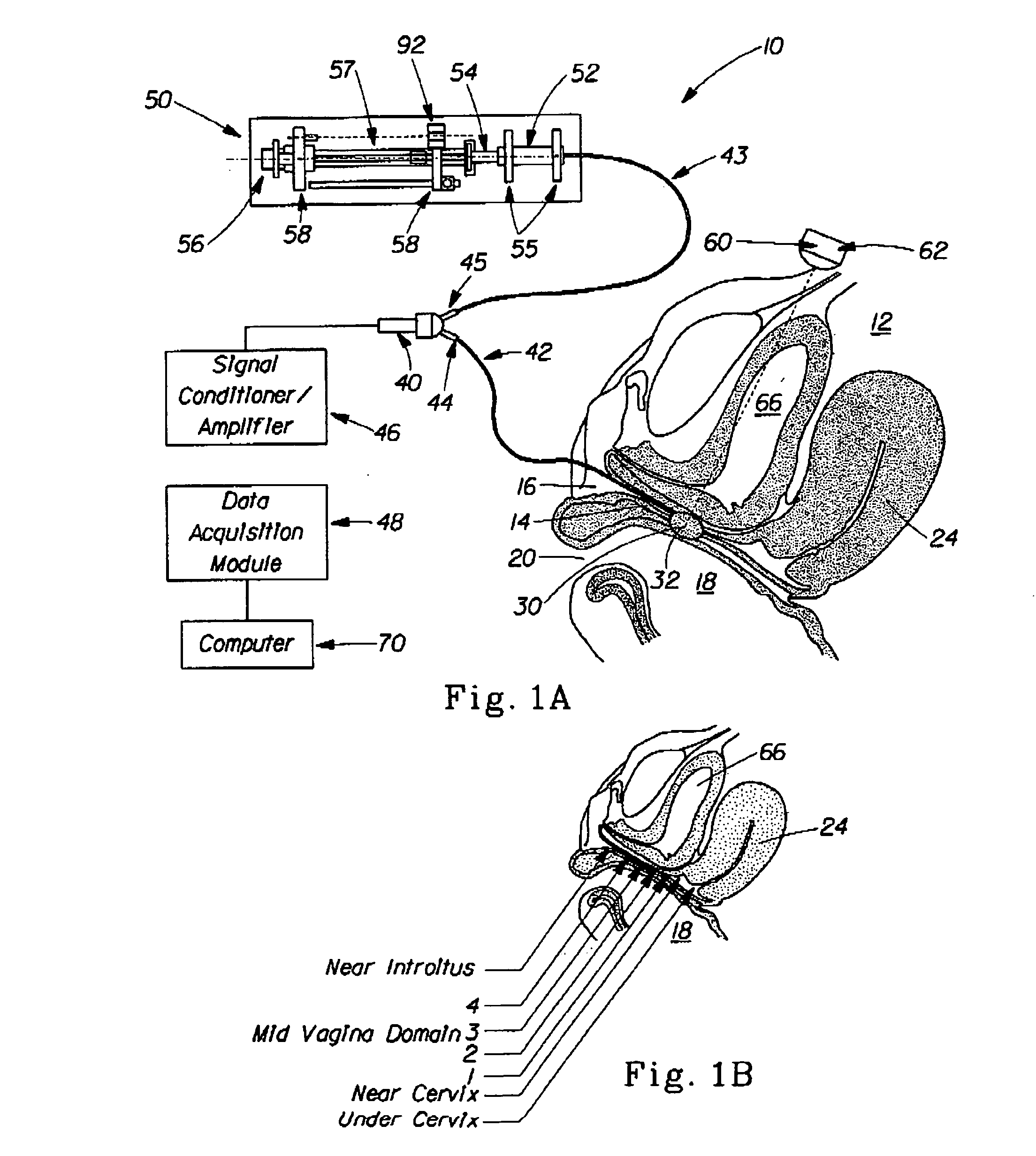 Computational model of the internal human pelvic environment