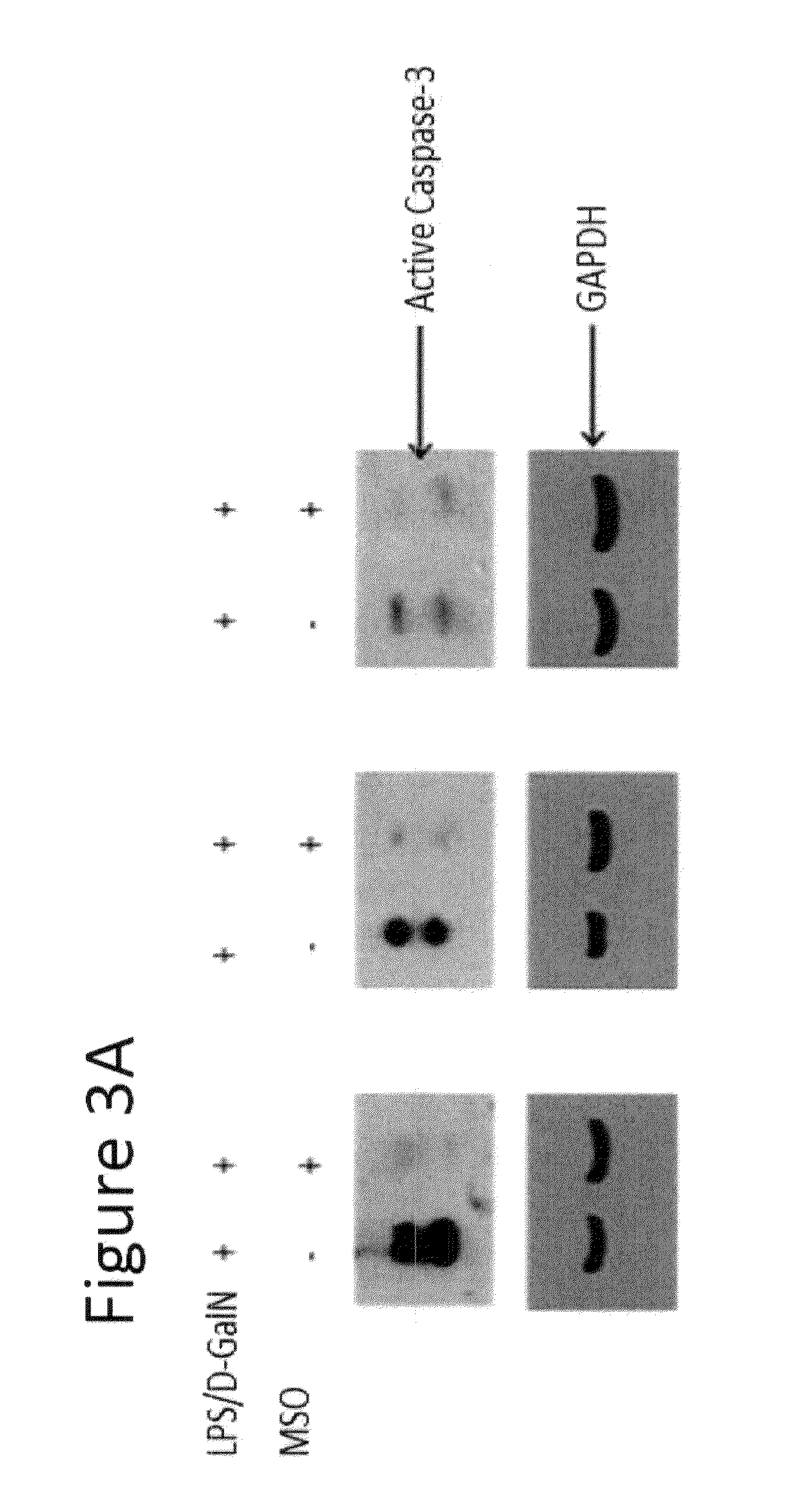 Use of methionine sulfoximine to treat acute liver failure and other diseases caused by an inflammatory cytokine response