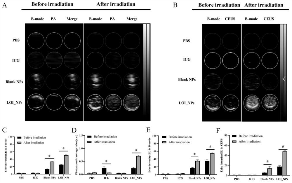 Lipopolysaccharide/indocyanine green/oxaliplatin nanoparticles and preparation method thereof