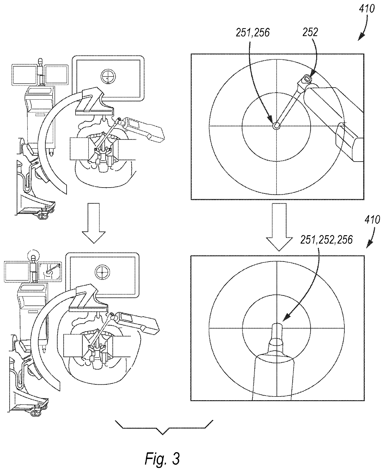 System and method for positioning a surgical tool