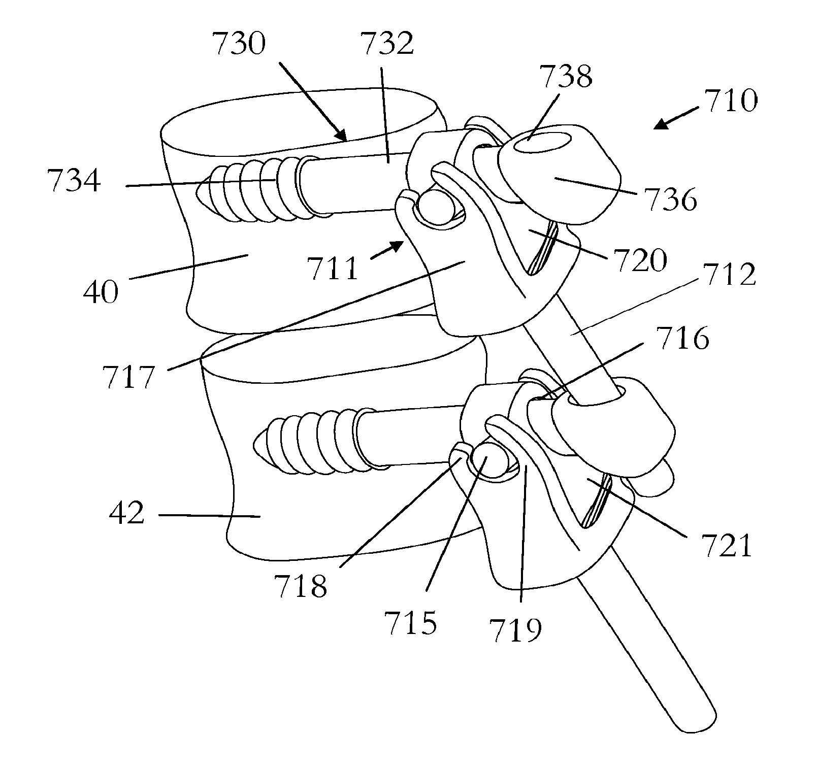 Surgical device for correction of spinal deformities