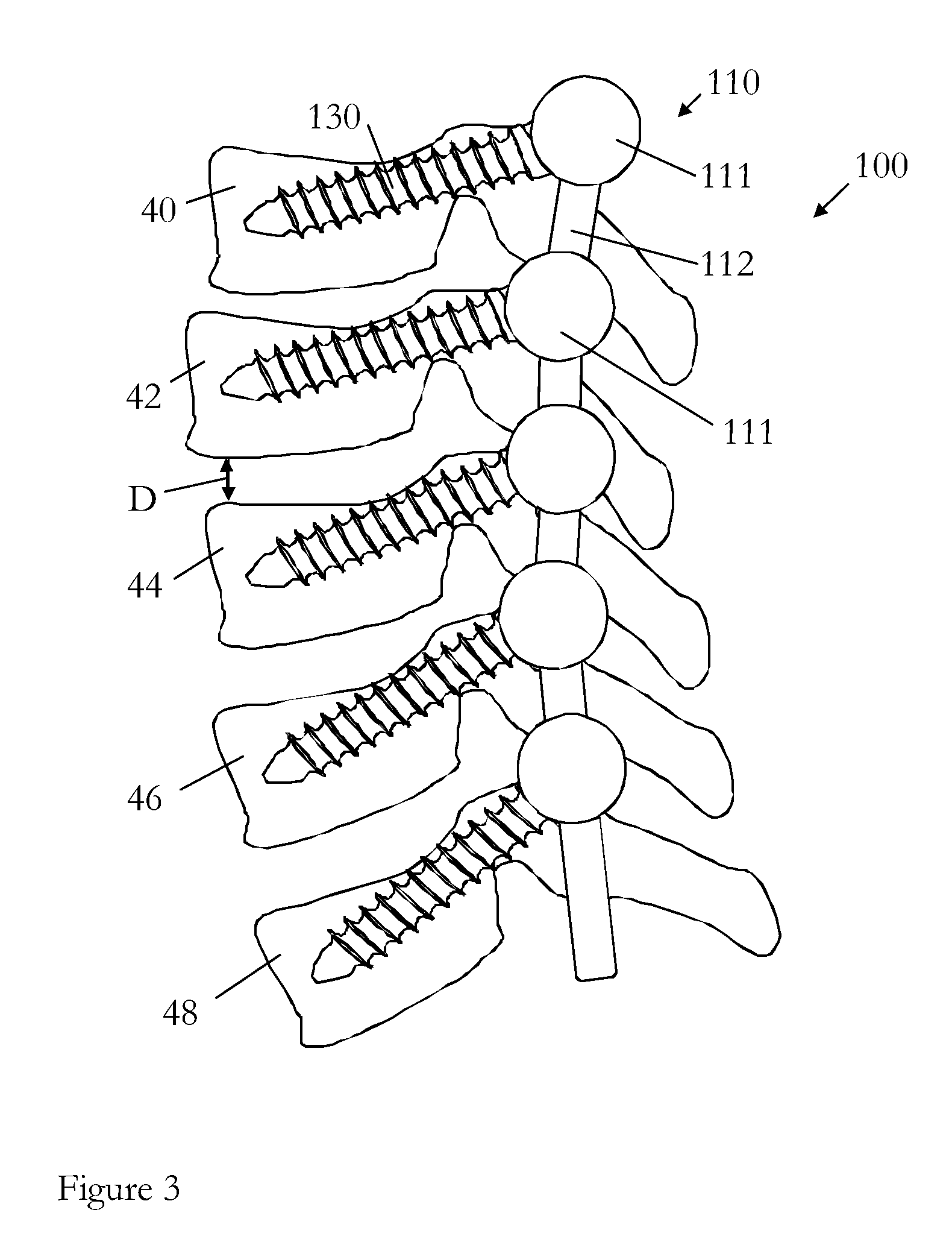 Surgical device for correction of spinal deformities