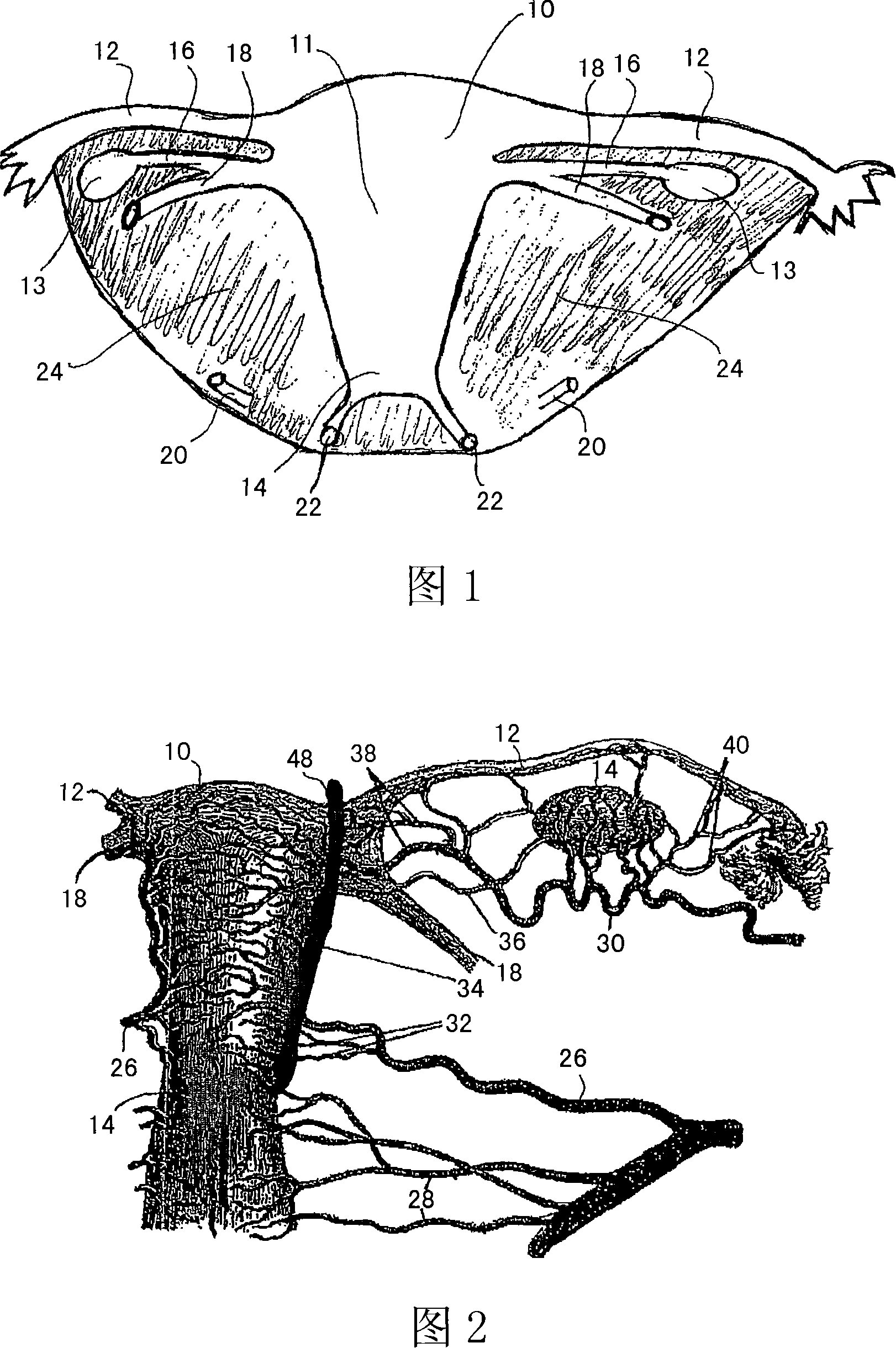 Method and apparatus for performing a surgical procedure