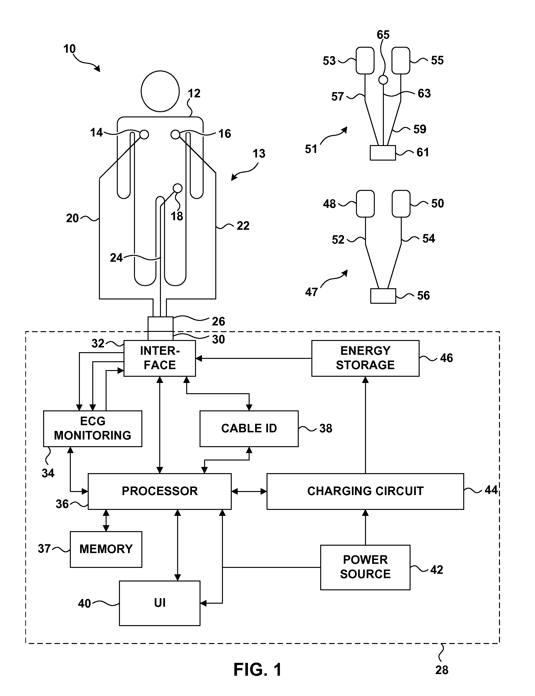 Electrocardiogram Monitoring