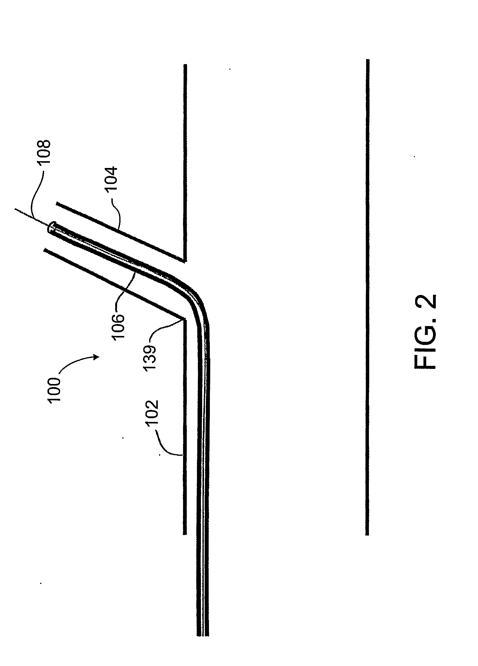 Stent graft fenestration