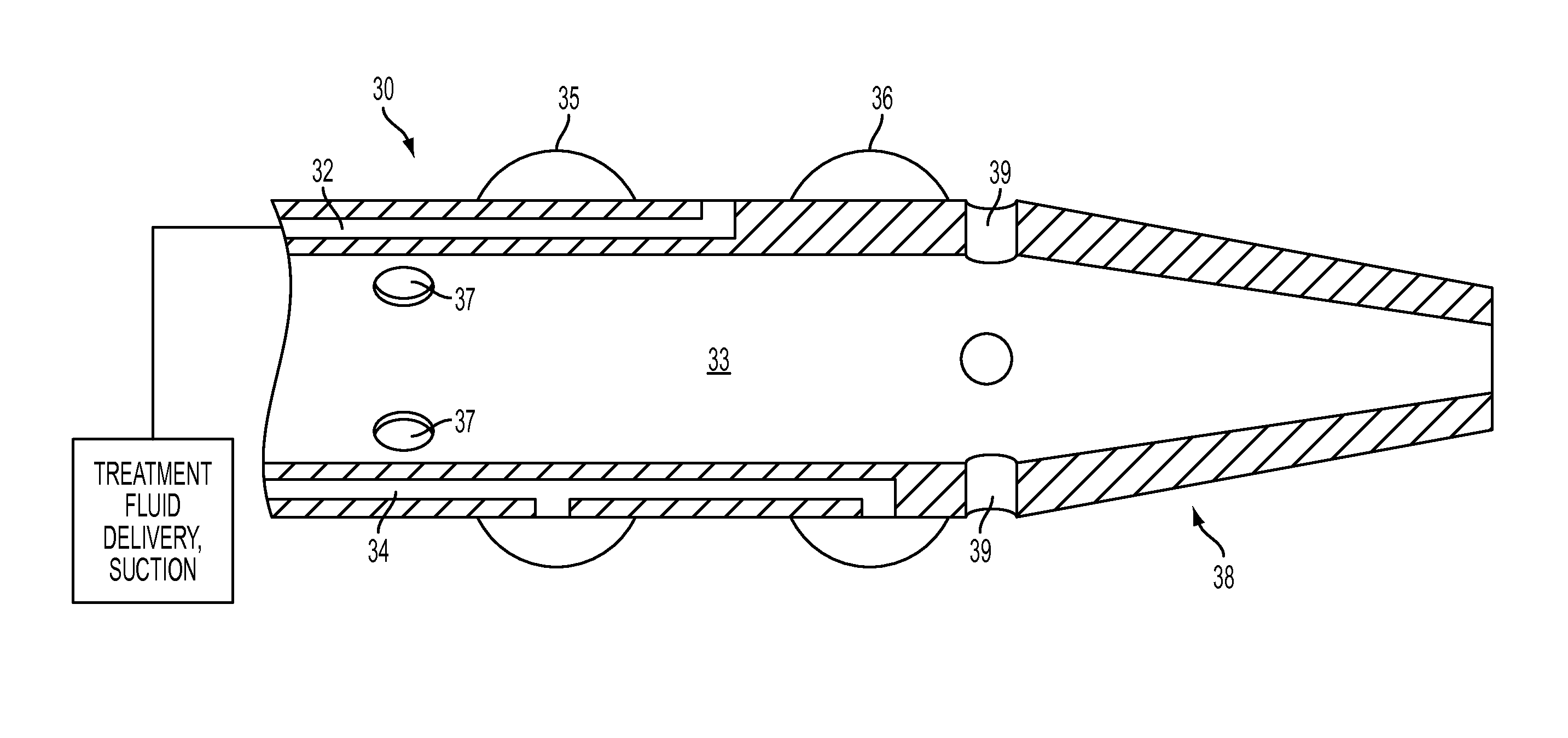 System for treating arterial obstructions