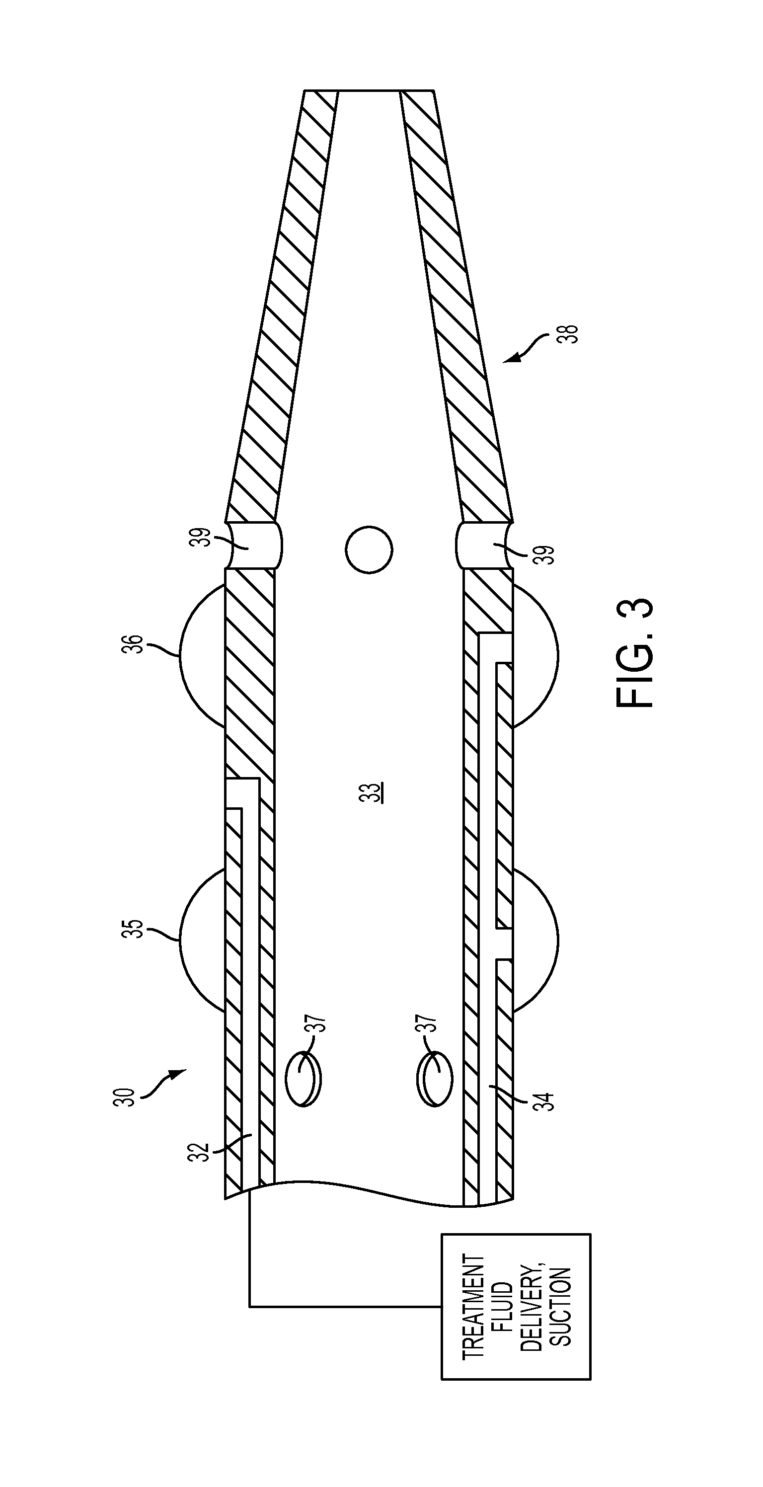 System for treating arterial obstructions