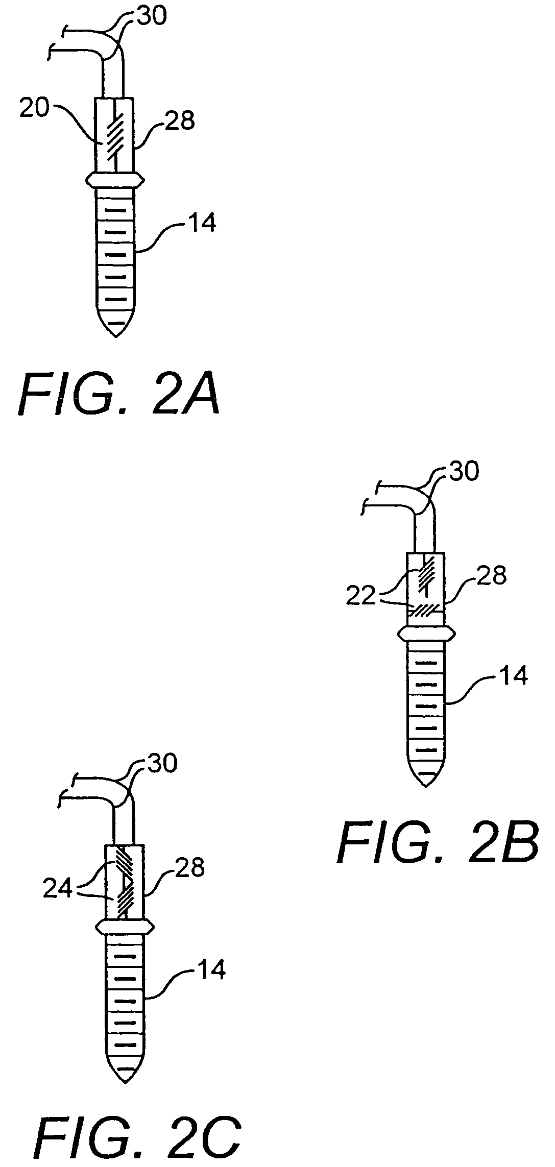 Surgical sensor