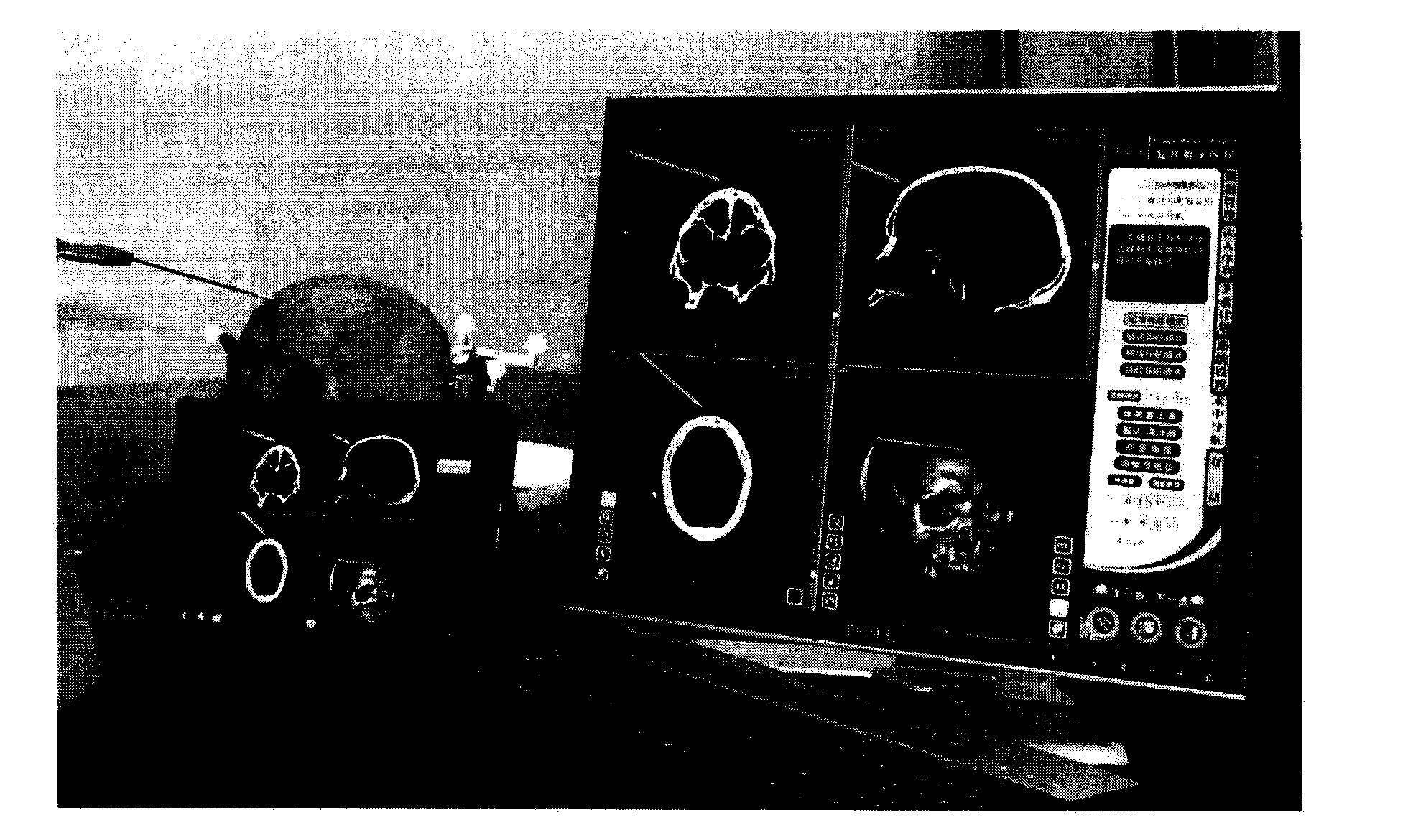 Volume data visualization method for surgical navigation based on PPC (Panel Personal Computer)