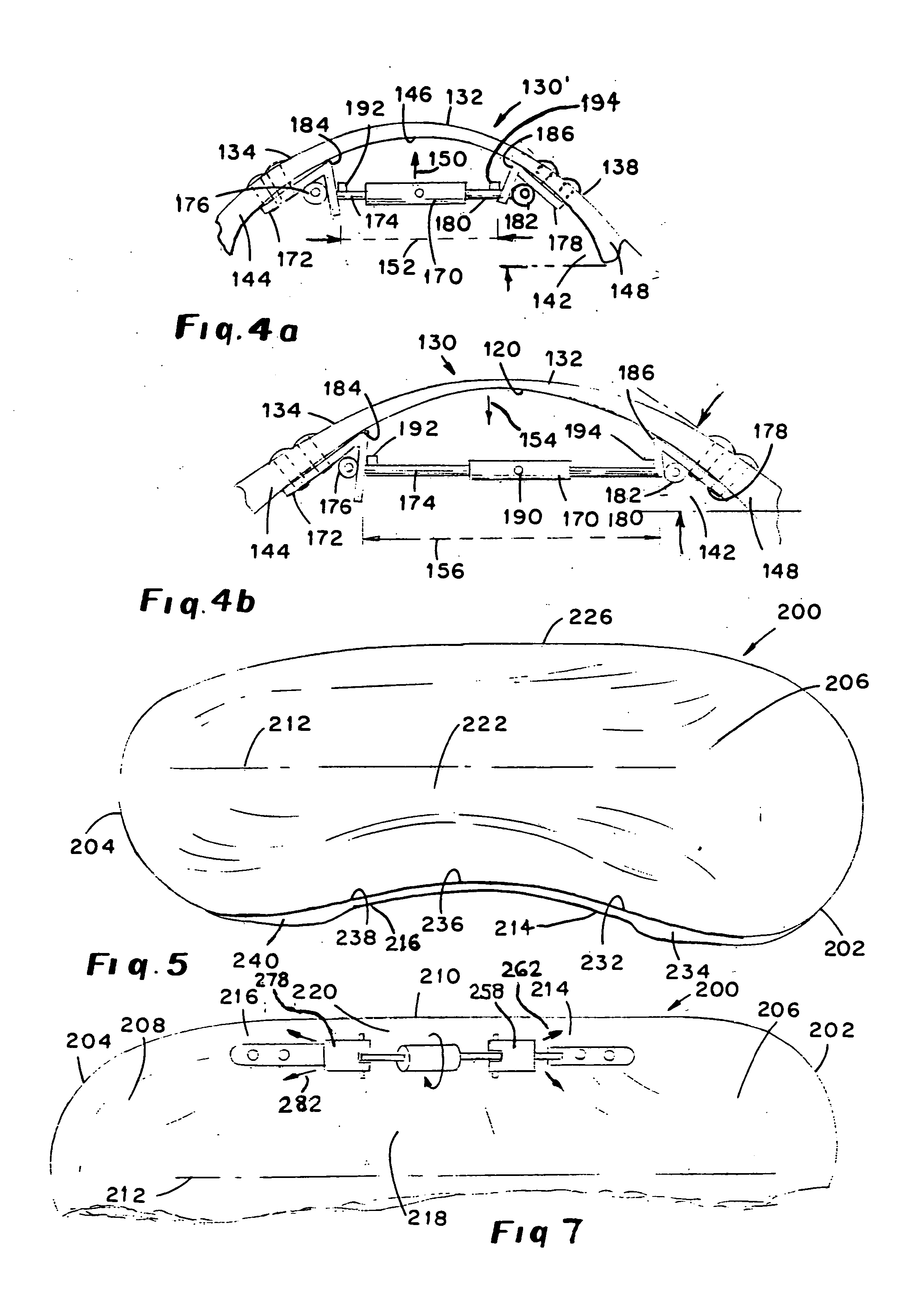 Adjustable arch support orthosis including variably tensioned arch curve and method of utilizing orthosis