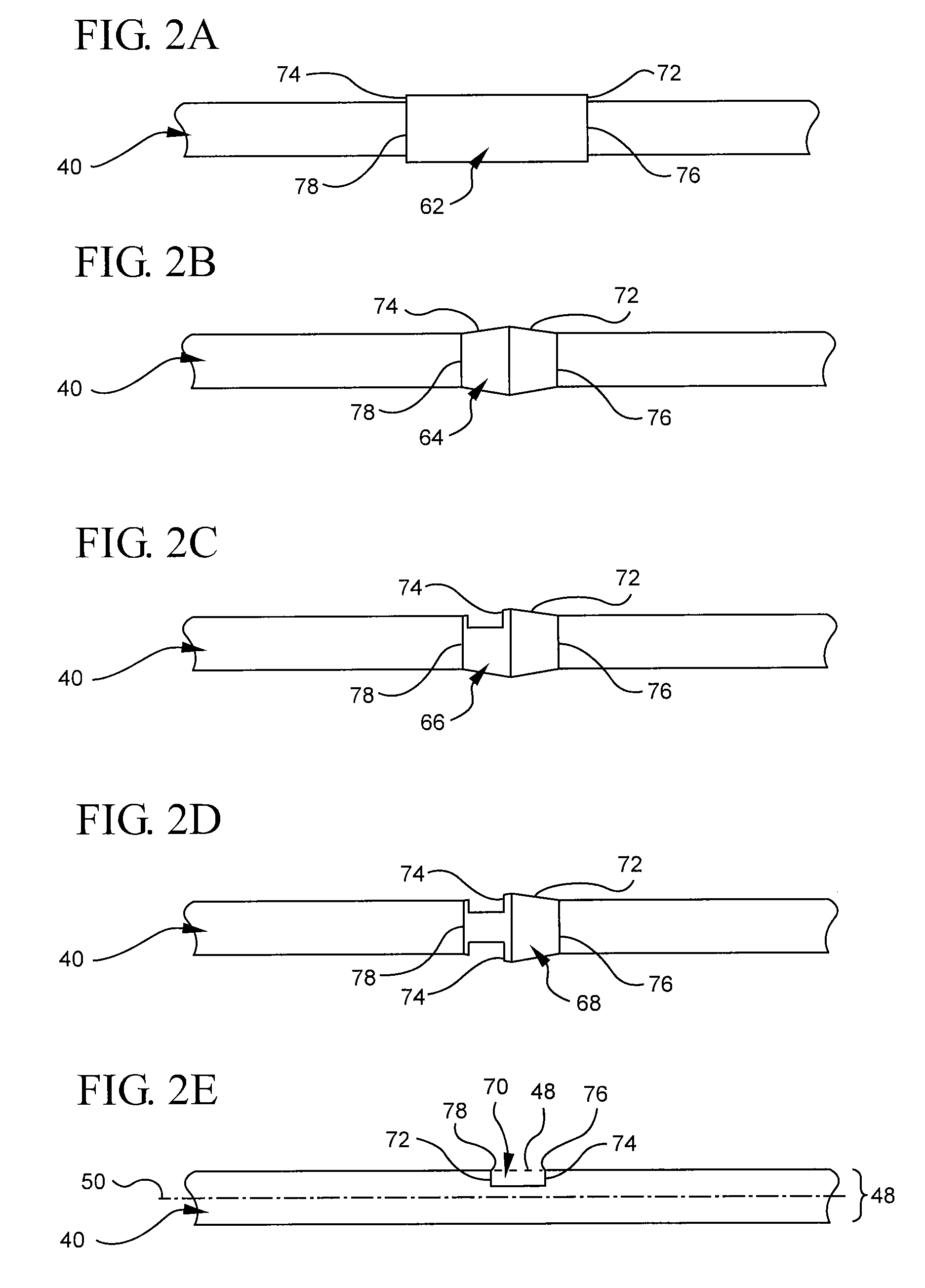 Bi-directional cannula feature capture mechanism