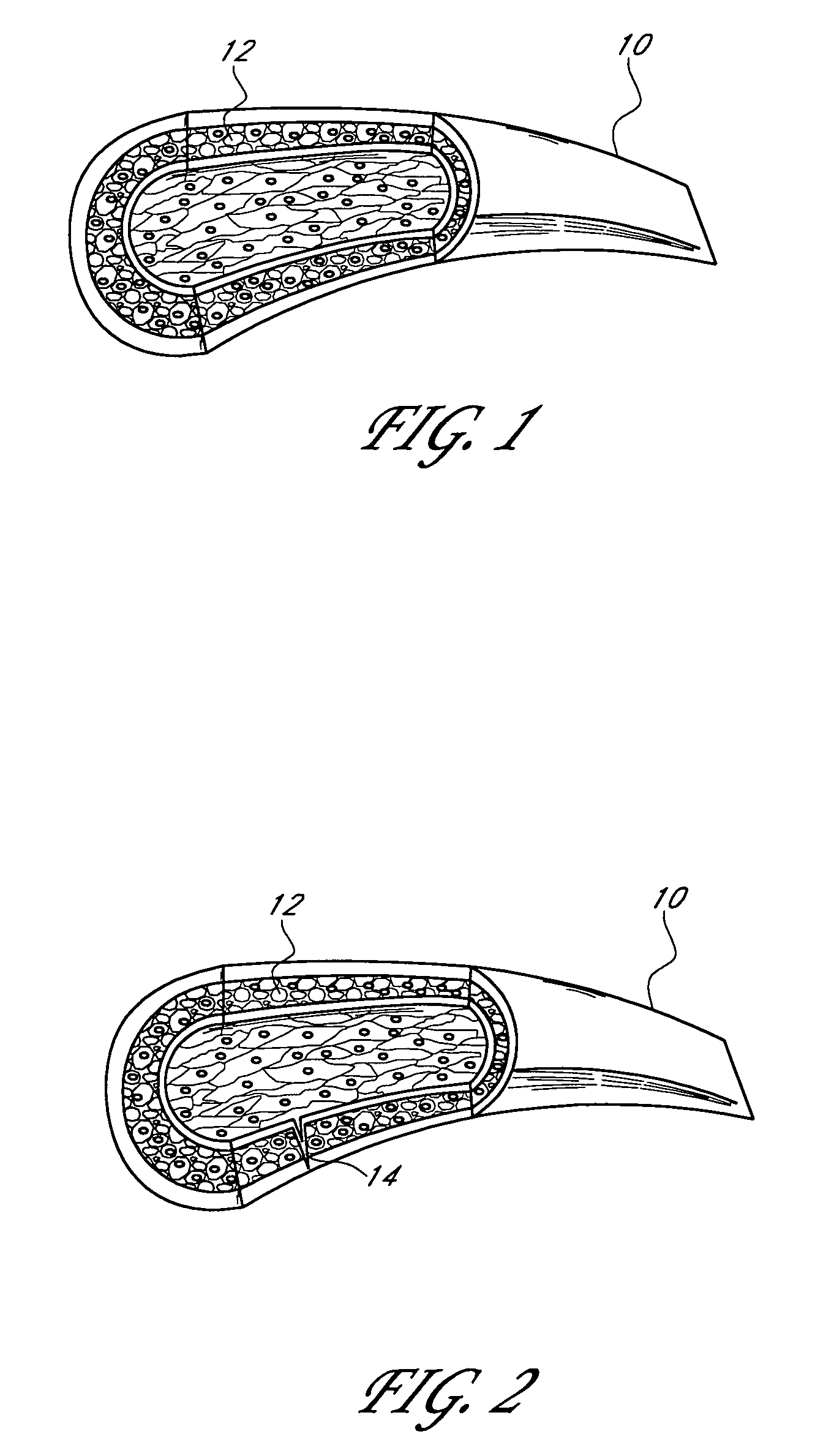 Apparatus and method for non-invasive diagnosing of coronary artery disease