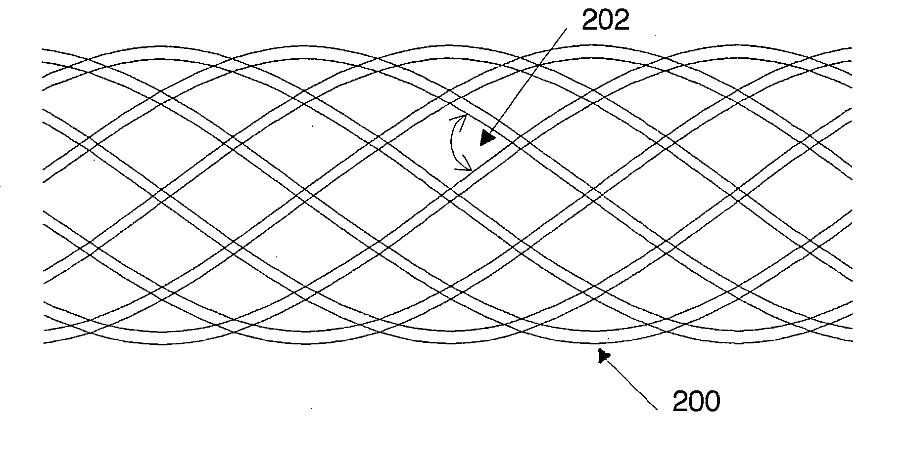 Implant of low radial strength