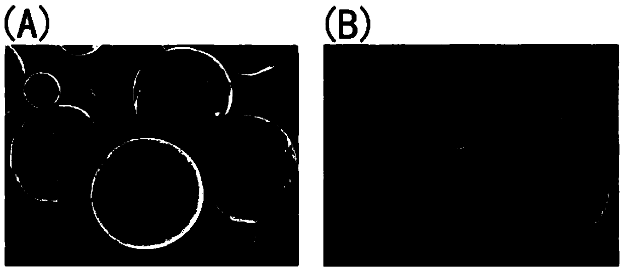 Microsphere-gel slow-release preparation for treating malignant tumor and thoracic-celiac metastasis