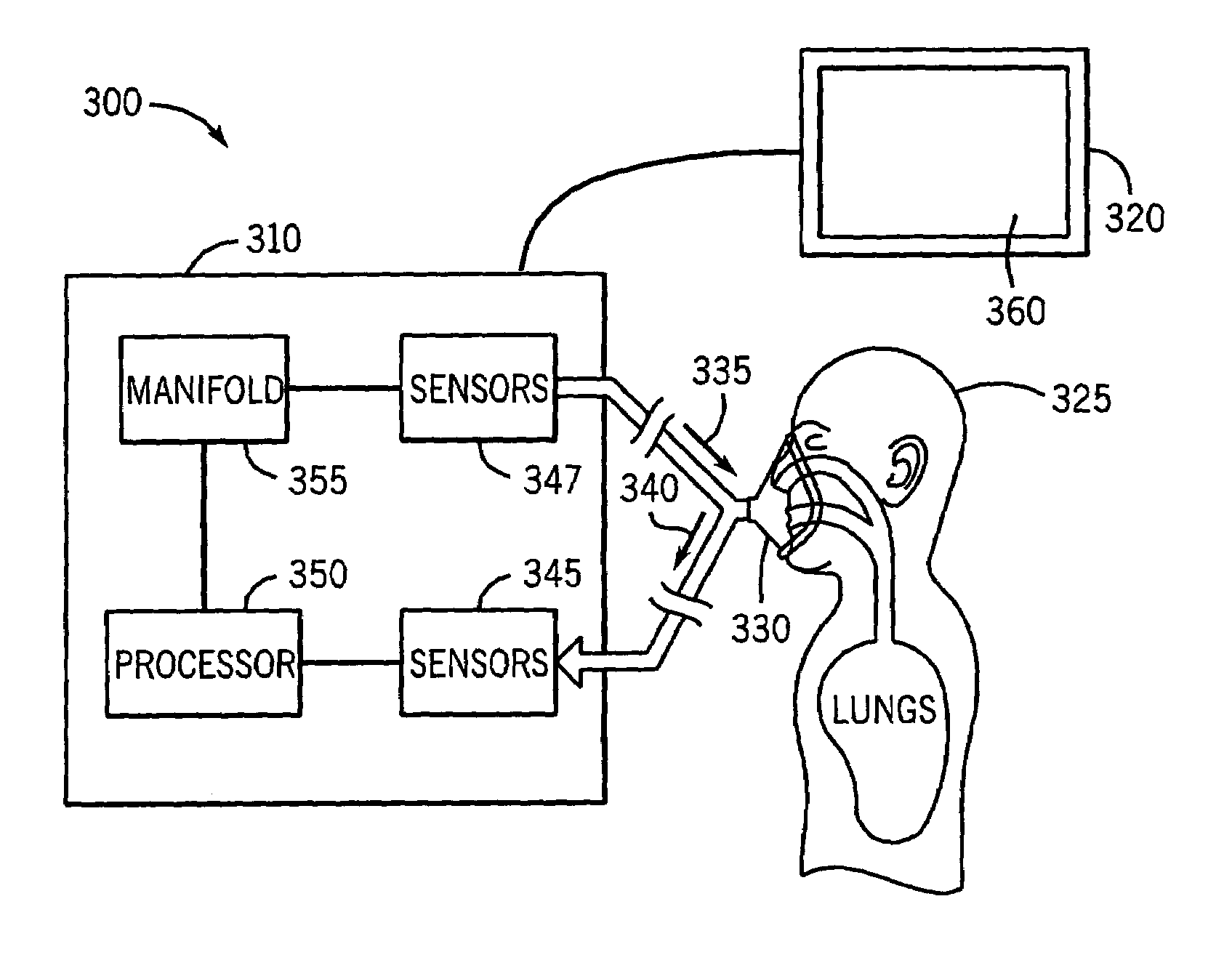 Adaptive patient trigger threshold detection