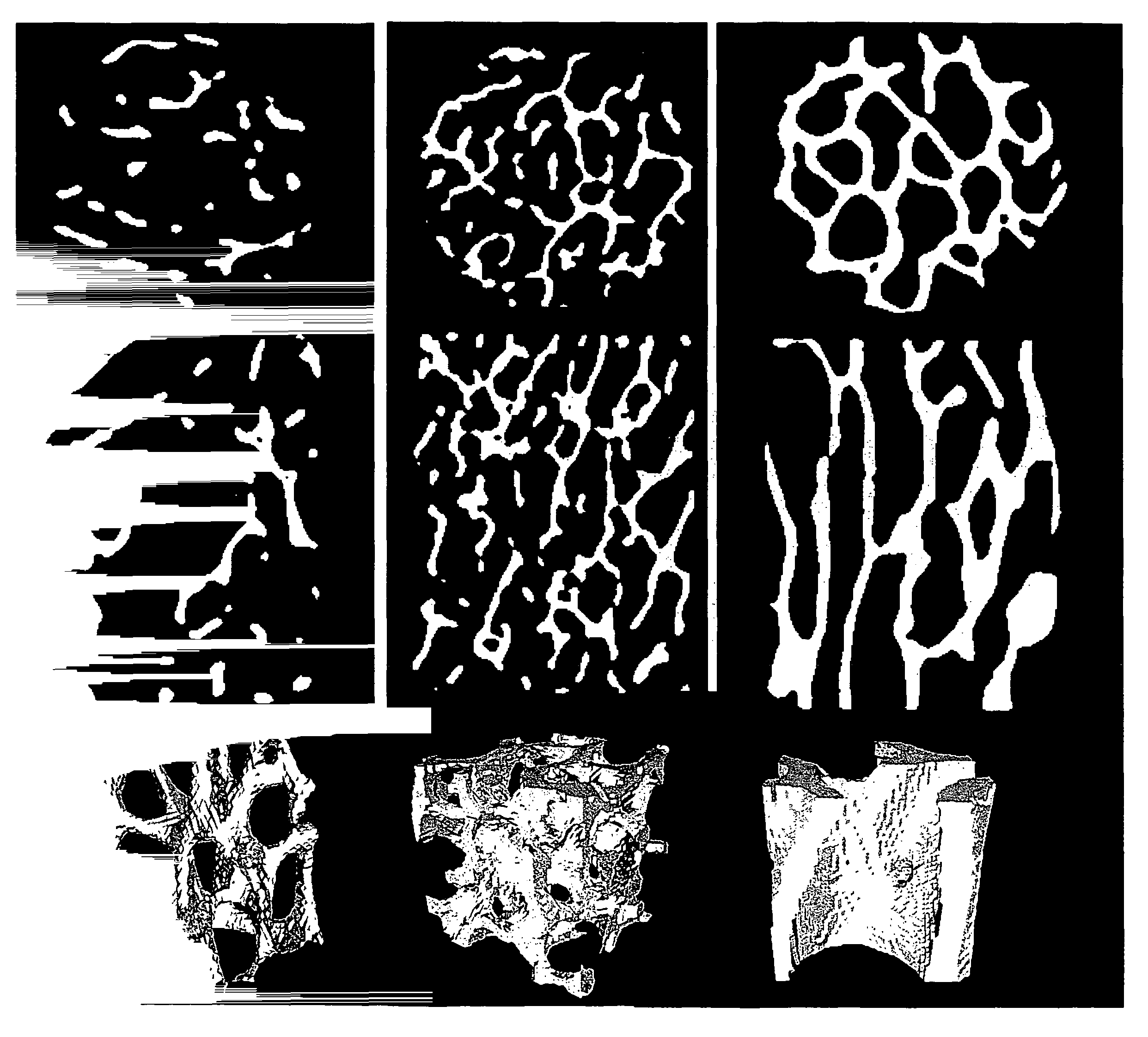 Diffusion-based magnetic resonance methods for characterizing bone structure