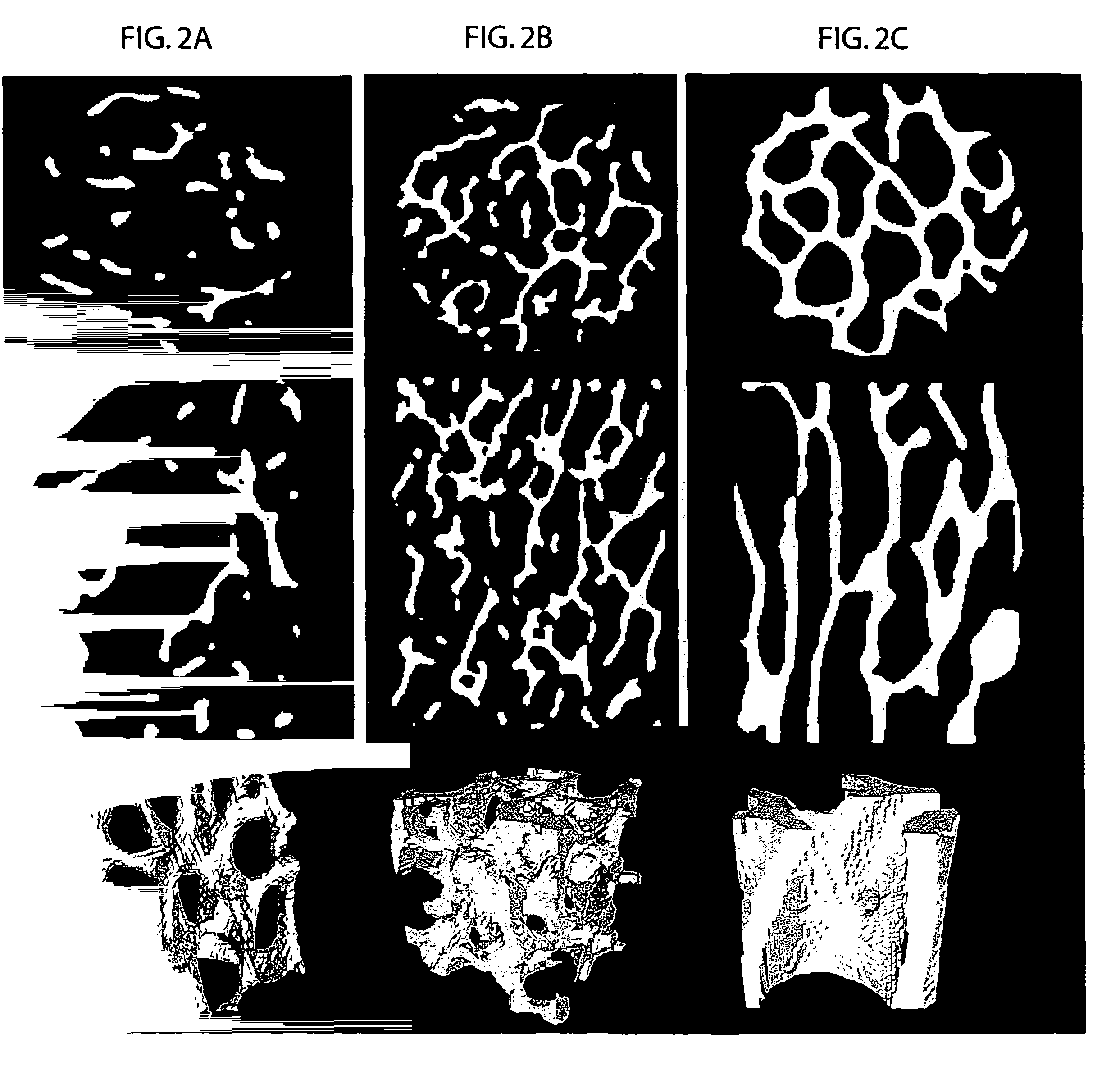 Diffusion-based magnetic resonance methods for characterizing bone structure