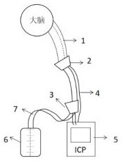 Dynamic monitoring and alarming automatic external ventricular drainage product