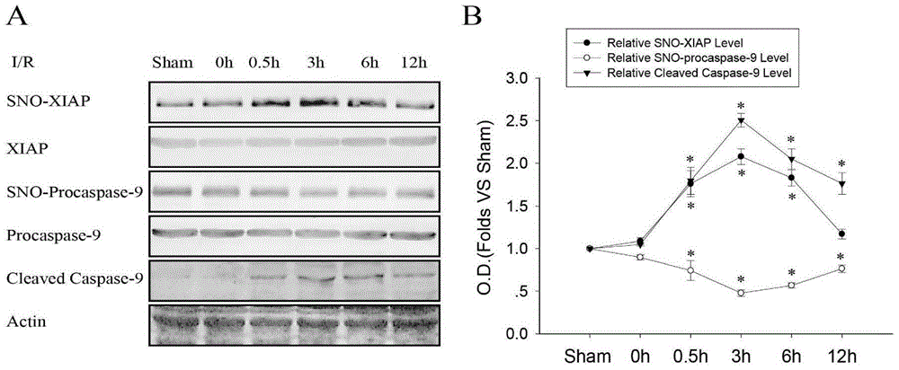 Small peptide TAT-AVPY for treating ischemic brain damage, and application thereof