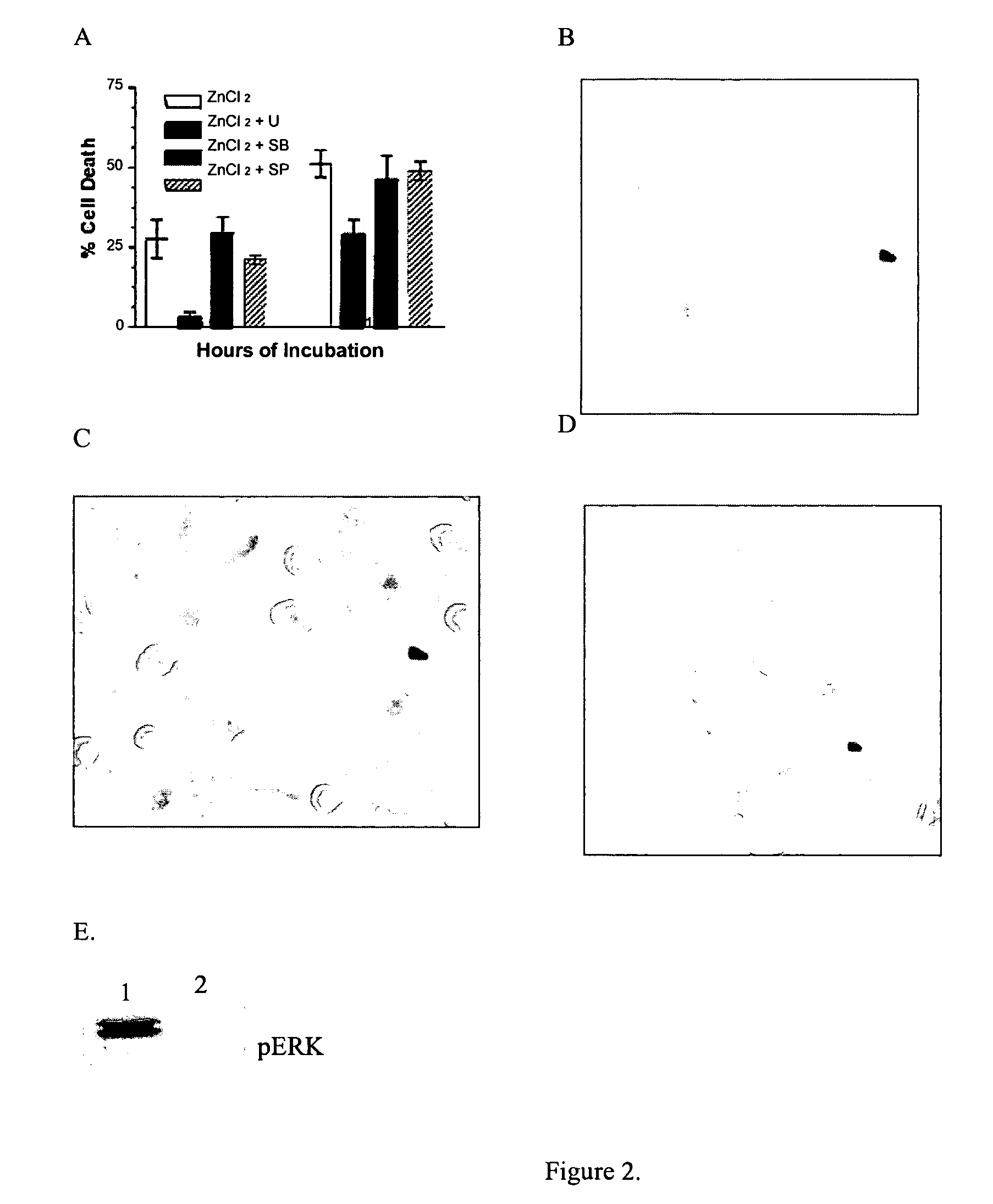 Methods and compositions for selectively killing cells