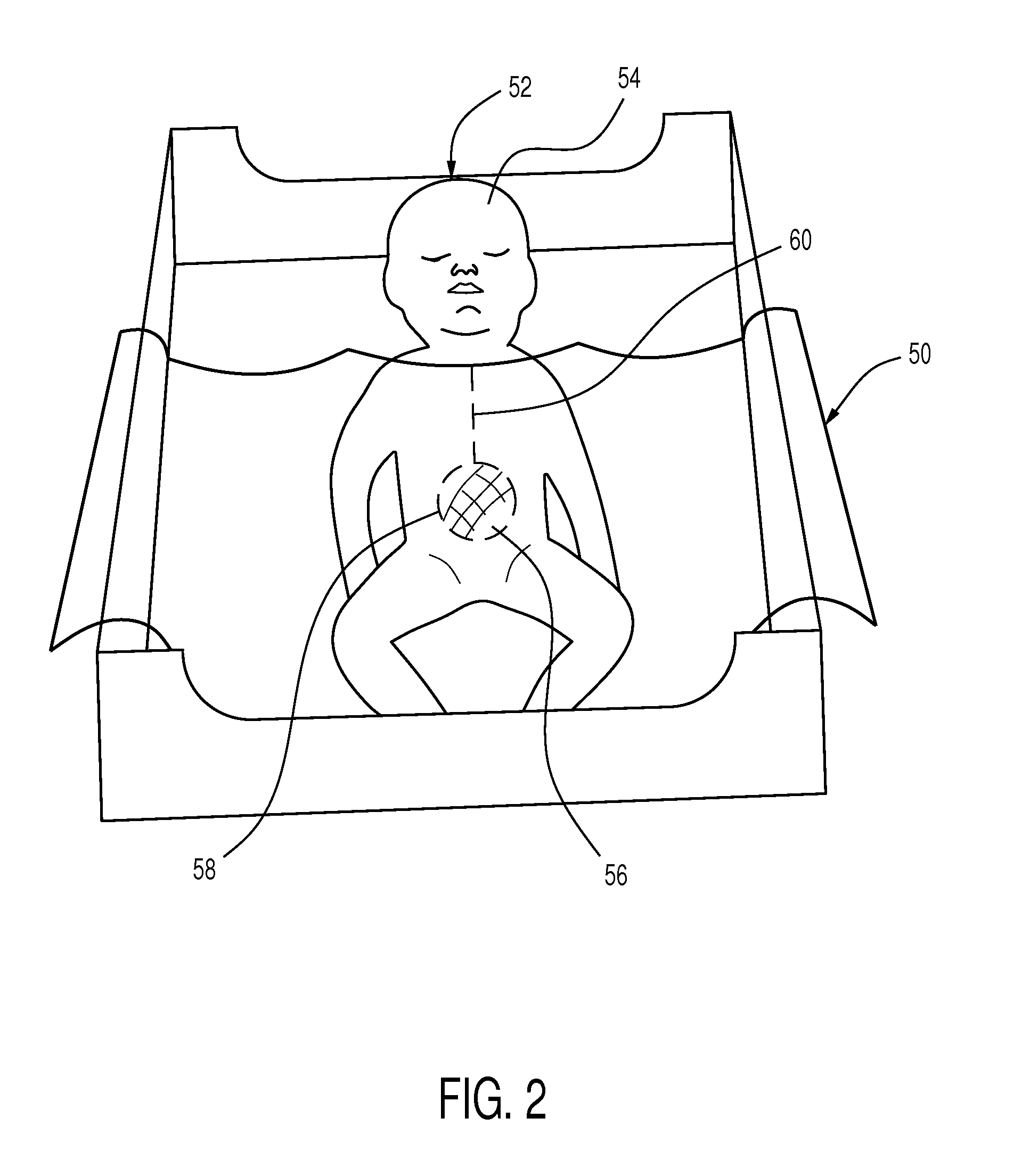 Drape and method of using same