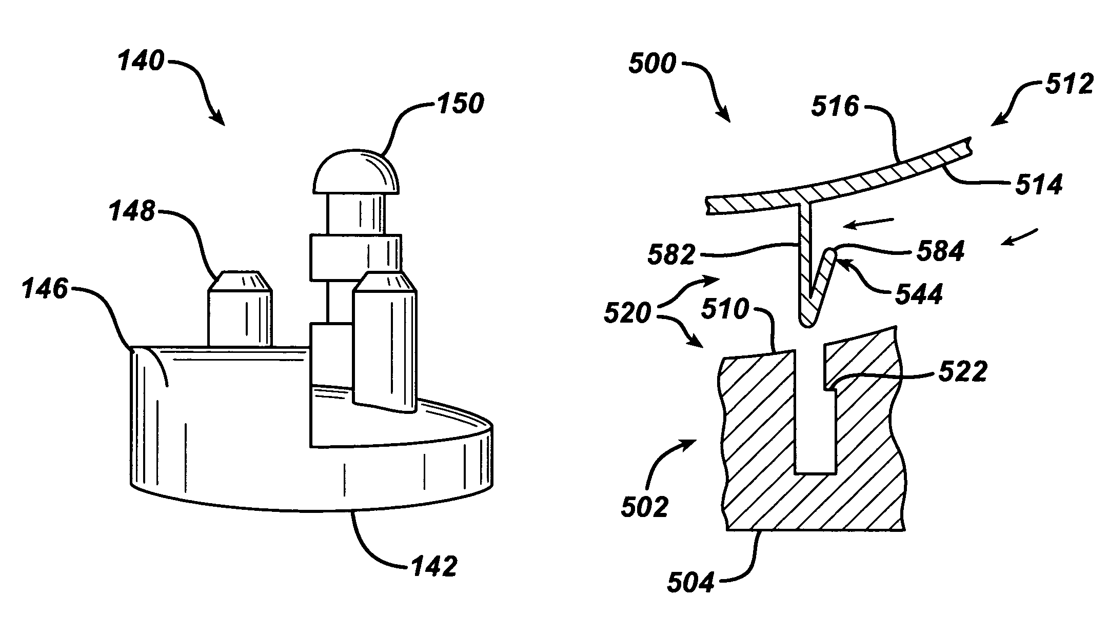 Glenoid augment and associated method