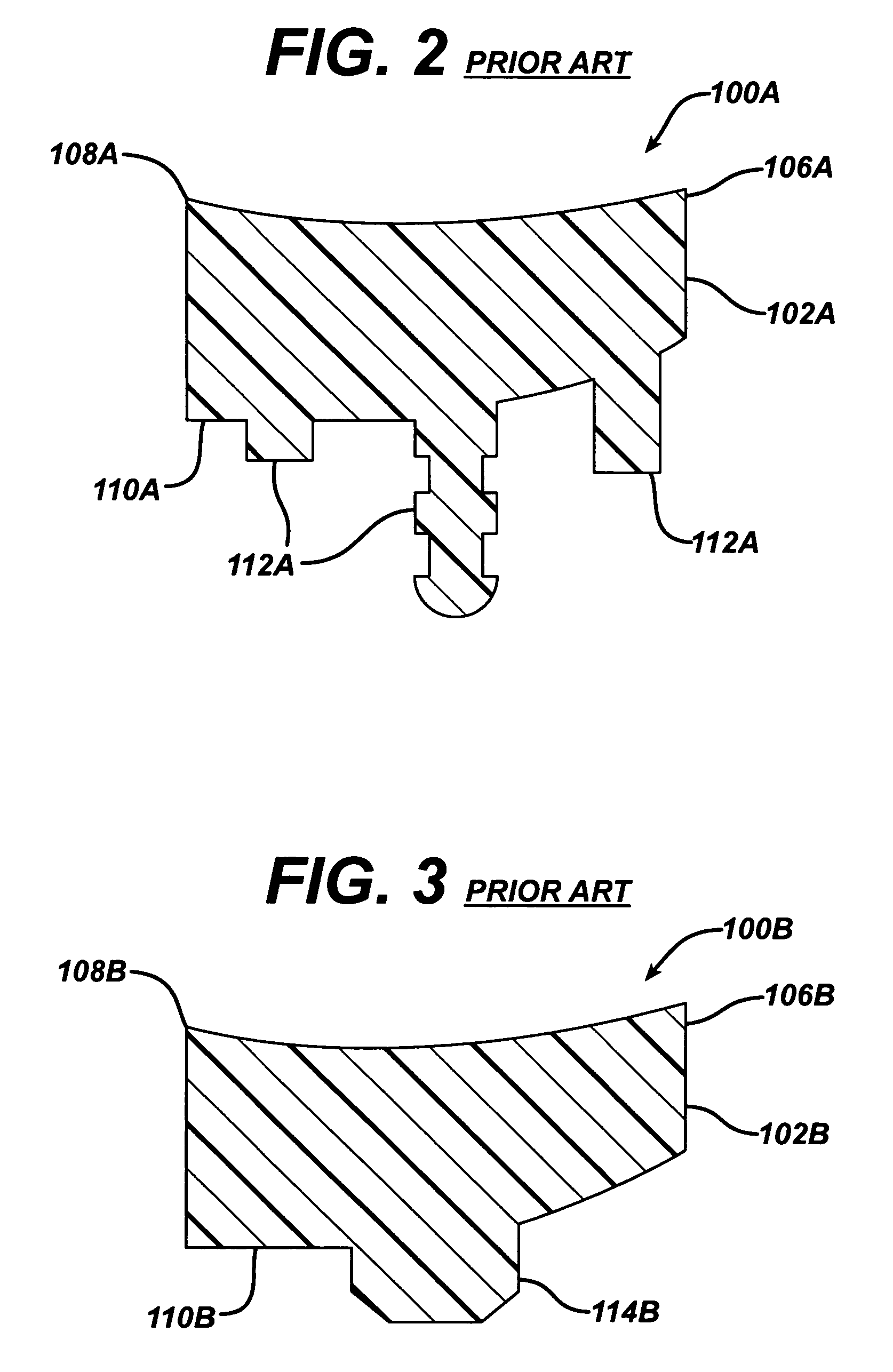 Glenoid augment and associated method