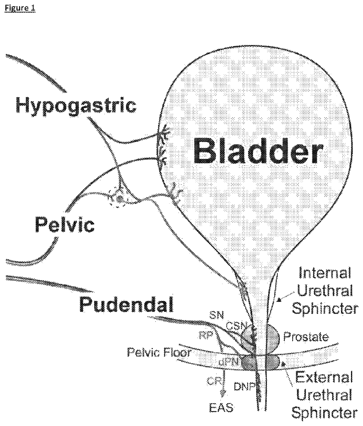 State-dependent peripheral neuromodulation to treat bladder dysfunction