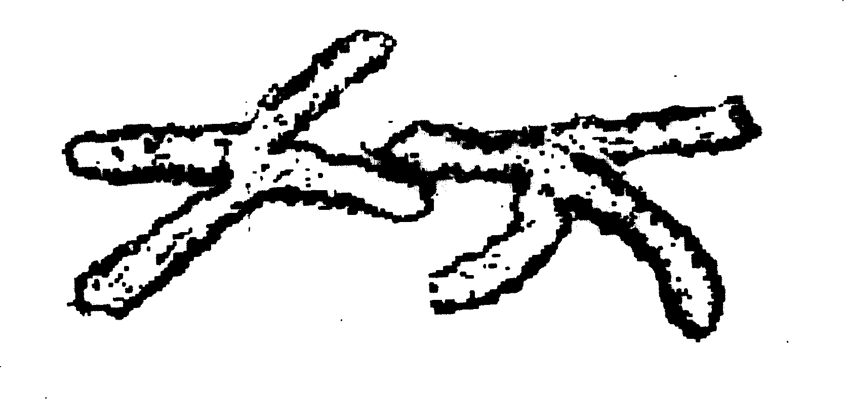 Viscose filament with abnormal section, preparation method thereof and spinneret assembly