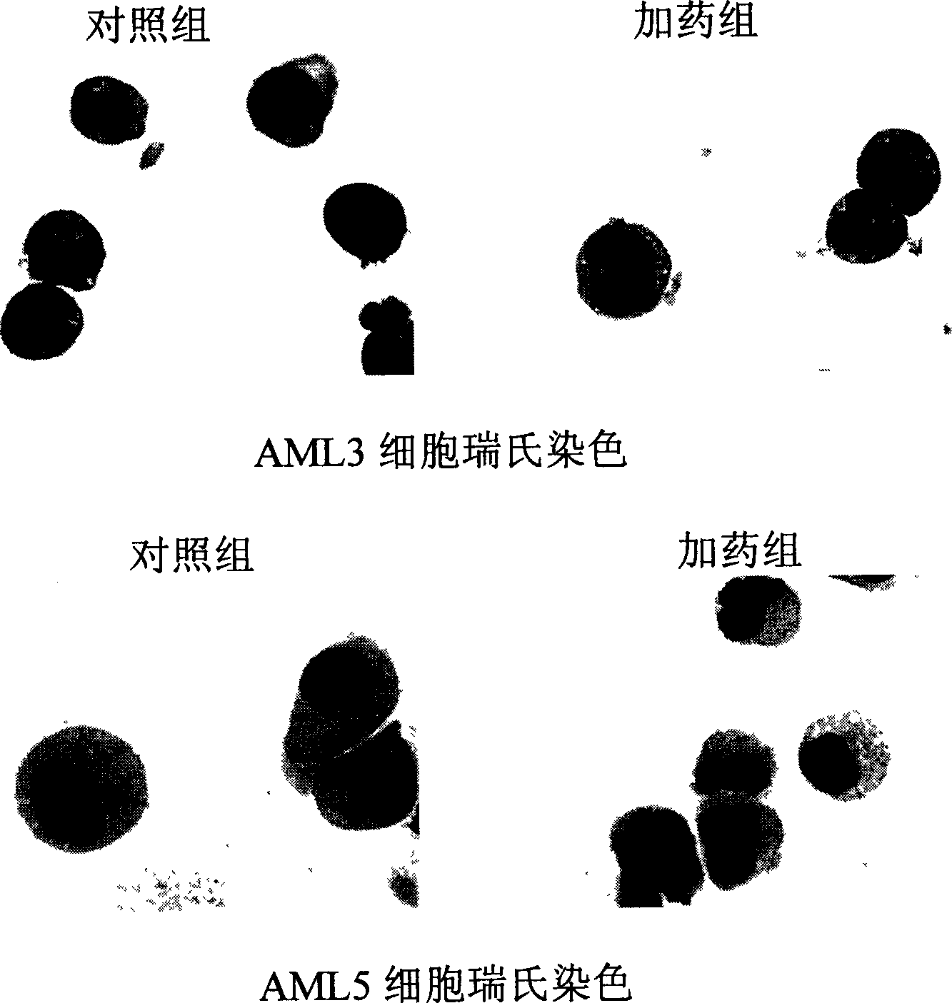 Engineering antibody against CD44 for inducing leukemia cell differentation and necrosis