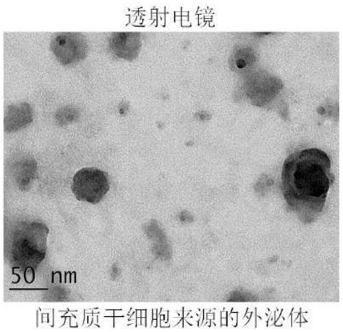 Preparation method and application of oral microspheres loaded with MSCs-derived exosomes