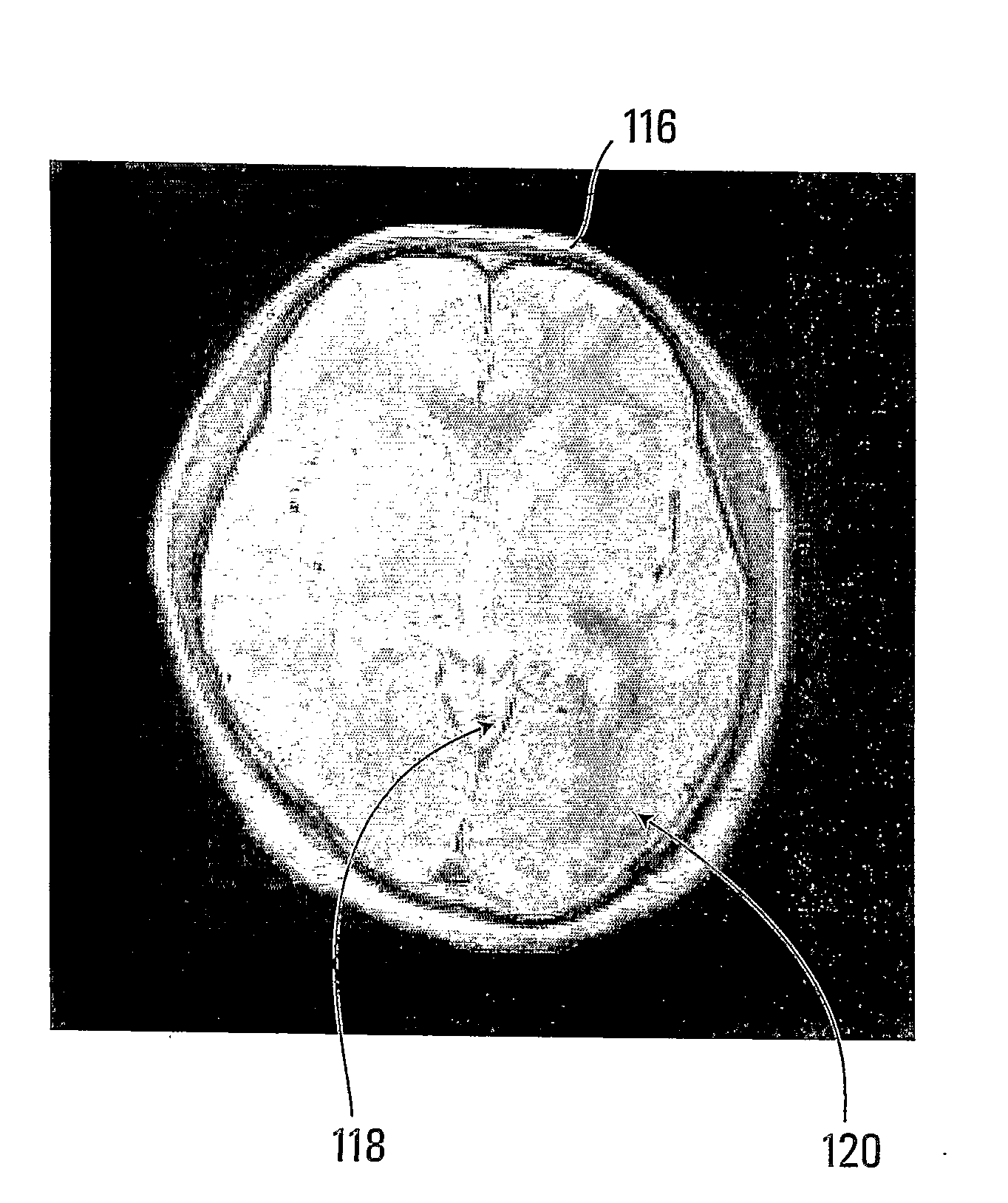 Method and apparatus for image segmentation