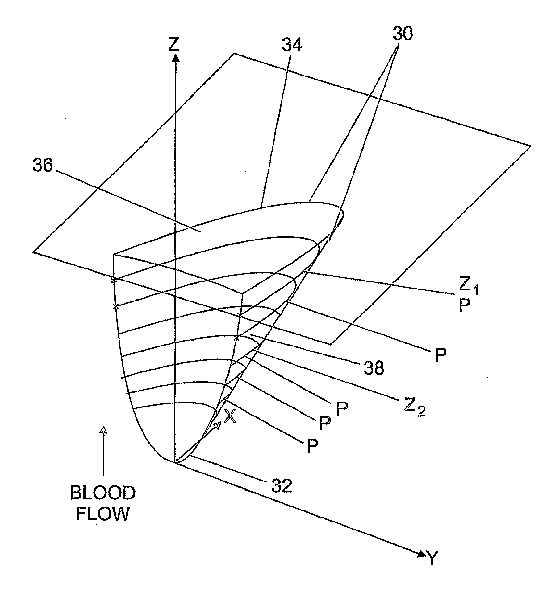 Method of making a cardiac valve