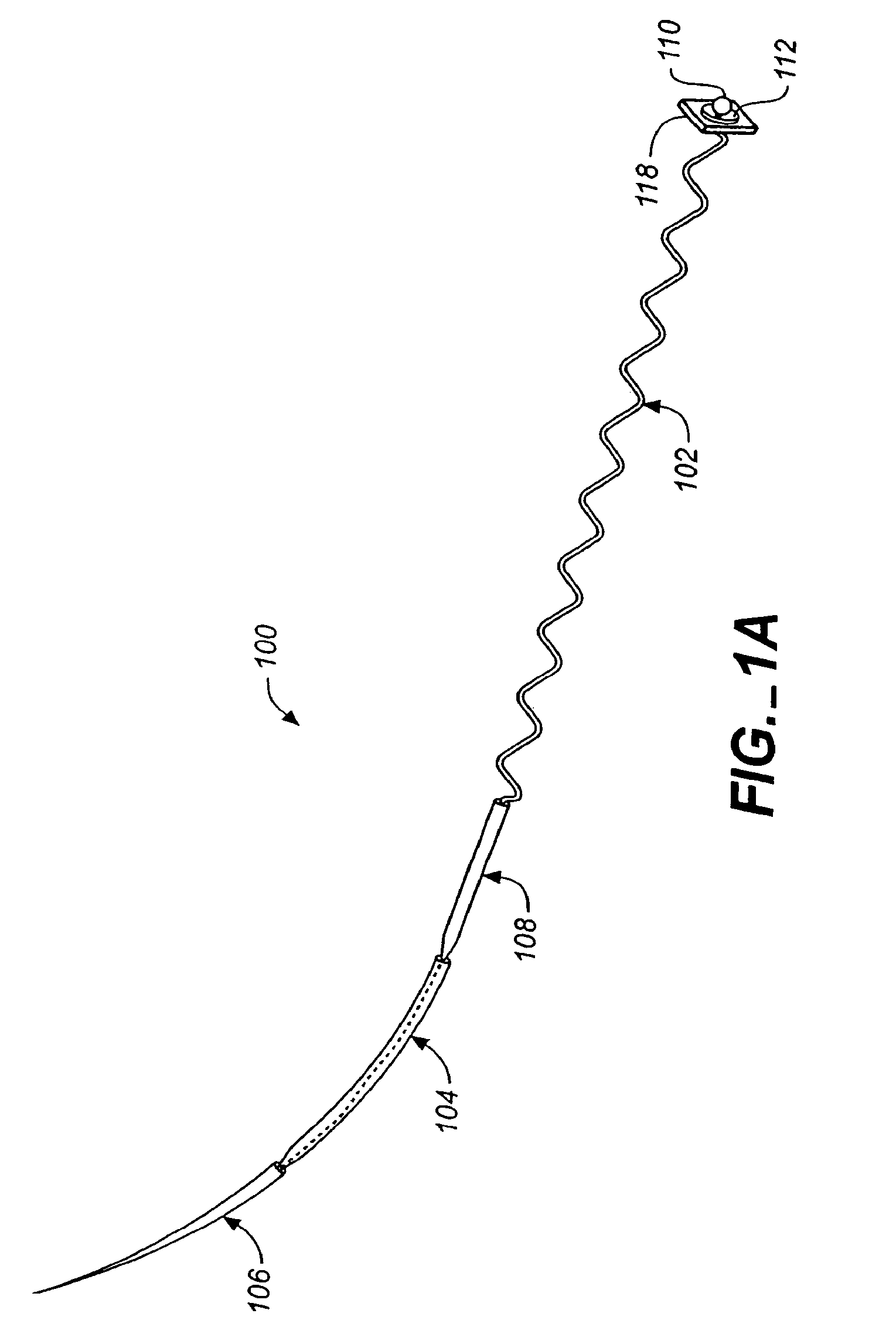 Annuloplasty apparatus and methods