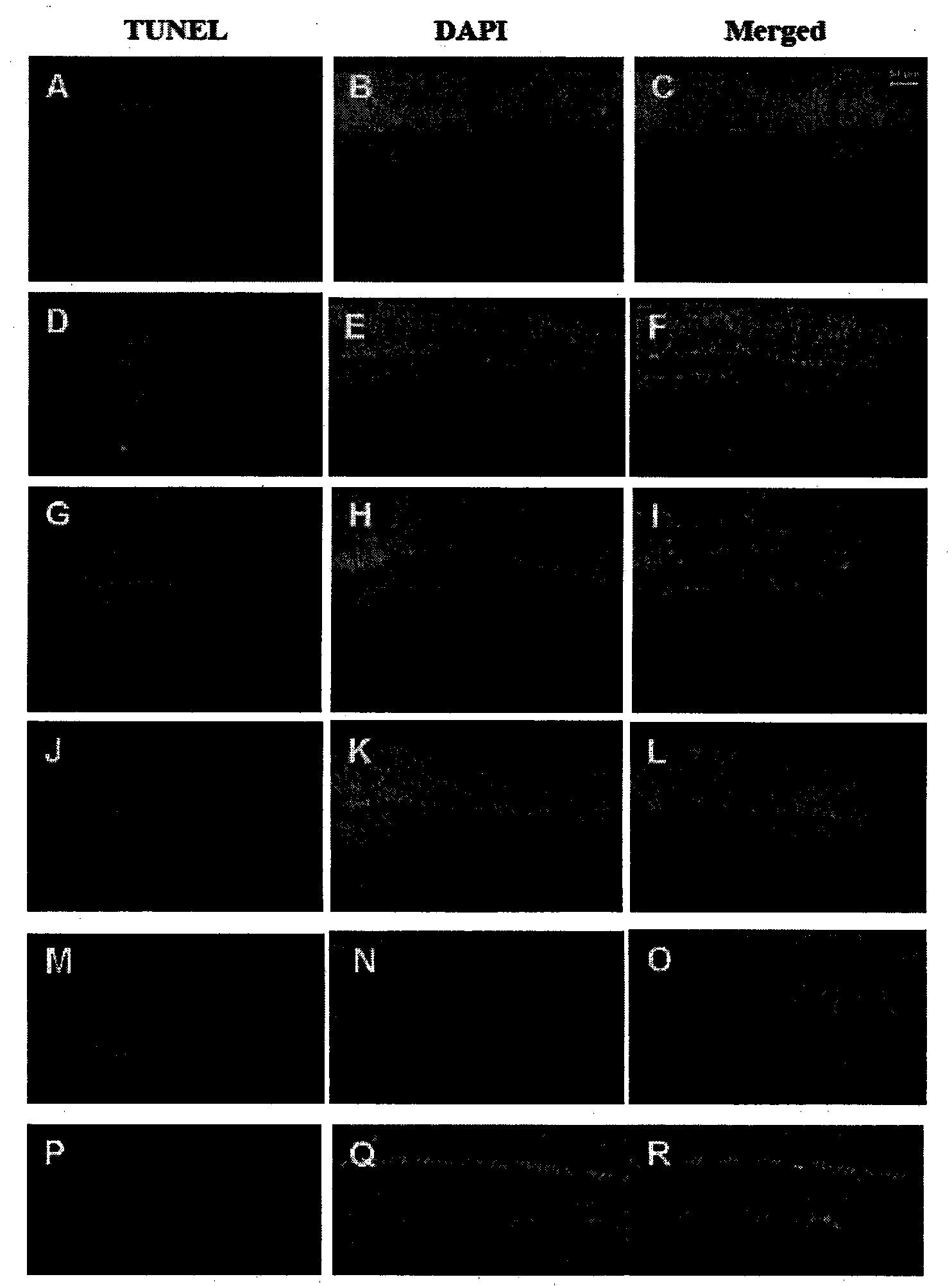 Long-acting sustained release preparation for preventing or treating retinal damage, and preparation method thereof