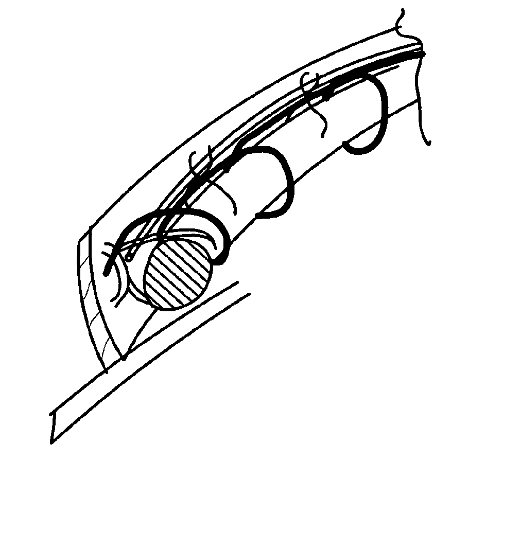 Delivery Device For Medical Implant And Medical Procedure