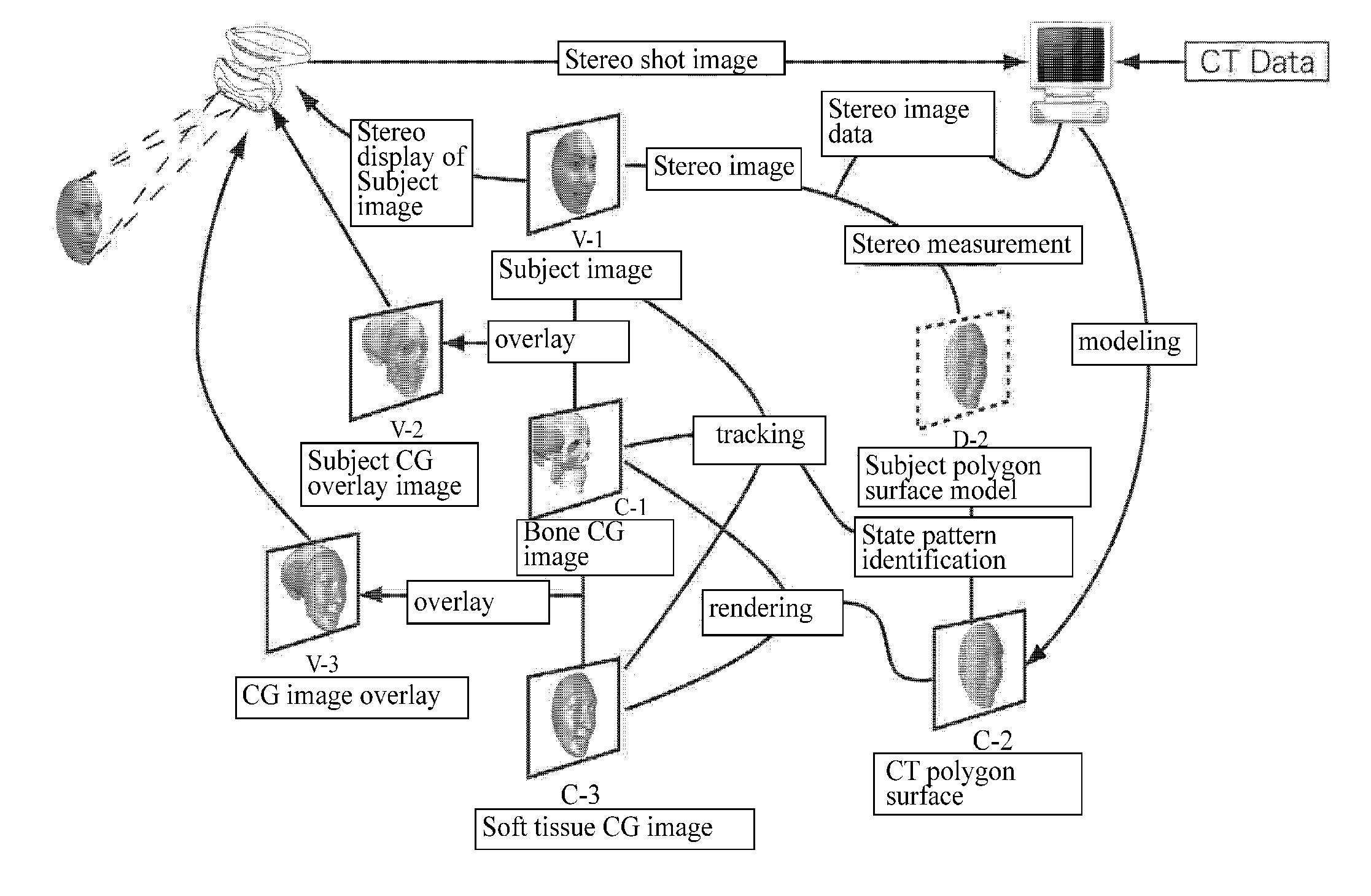 Three-dimensional digital magnifier operation supporting system