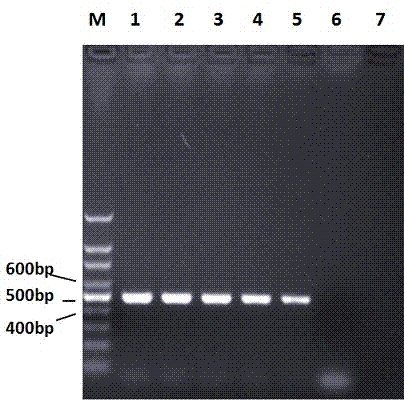 PCR (Polymerase Chain Reaction) amplification primer for quickly detecting mycoplasma ovipneumoniae, and application thereof