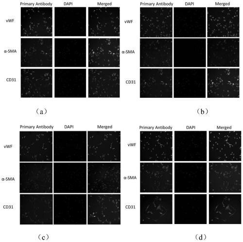 Primary isolation and culture method of human umbilical vein endothelium