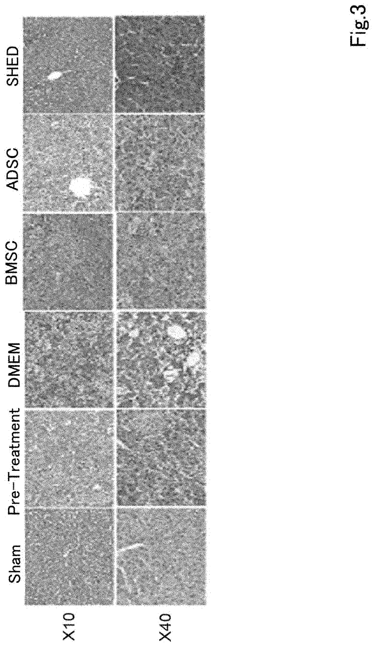 Composition for preventing or treating inflammatory disease