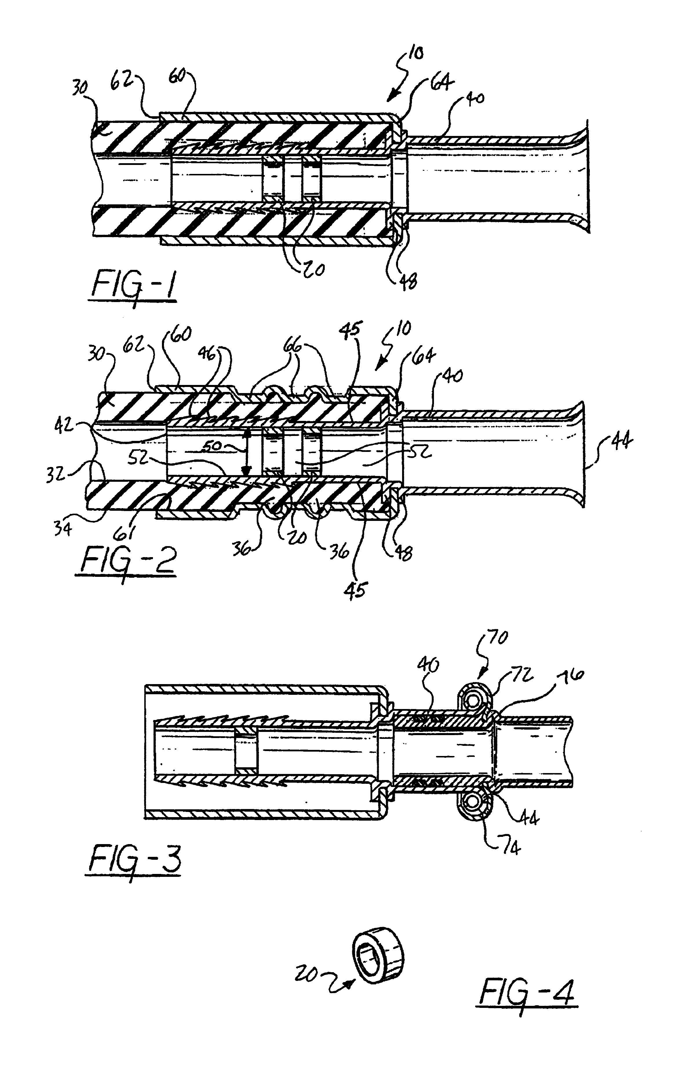 Reinforcement for a hose coupling