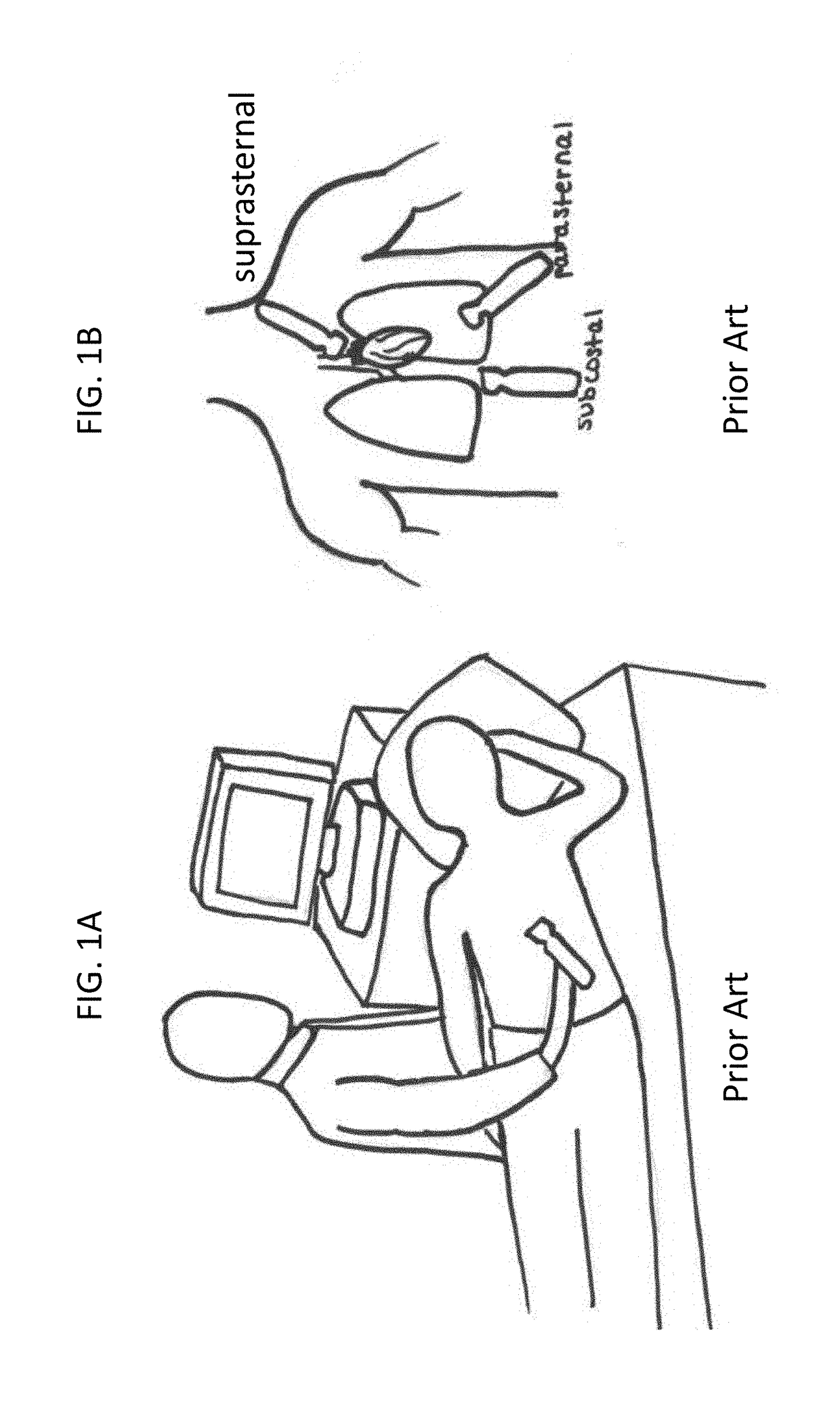 Ultrasound transducer holder