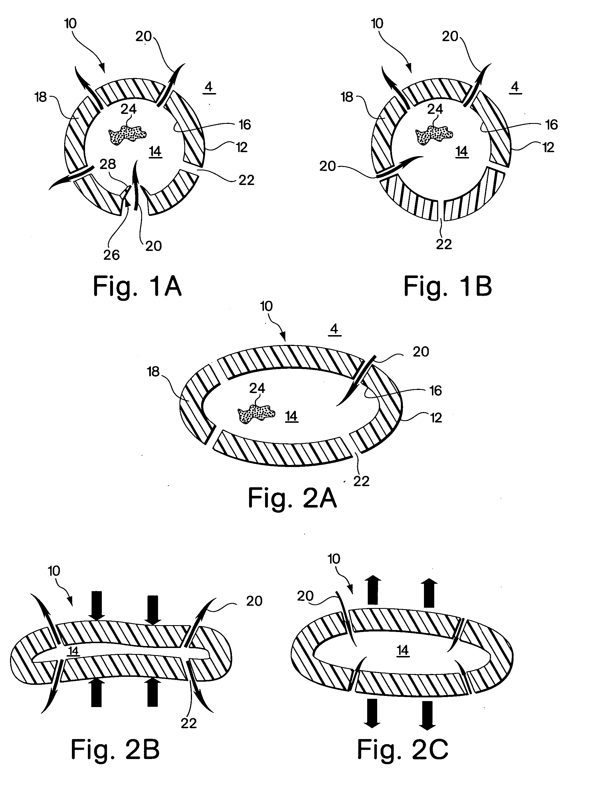 Flexible vascular inducing implants