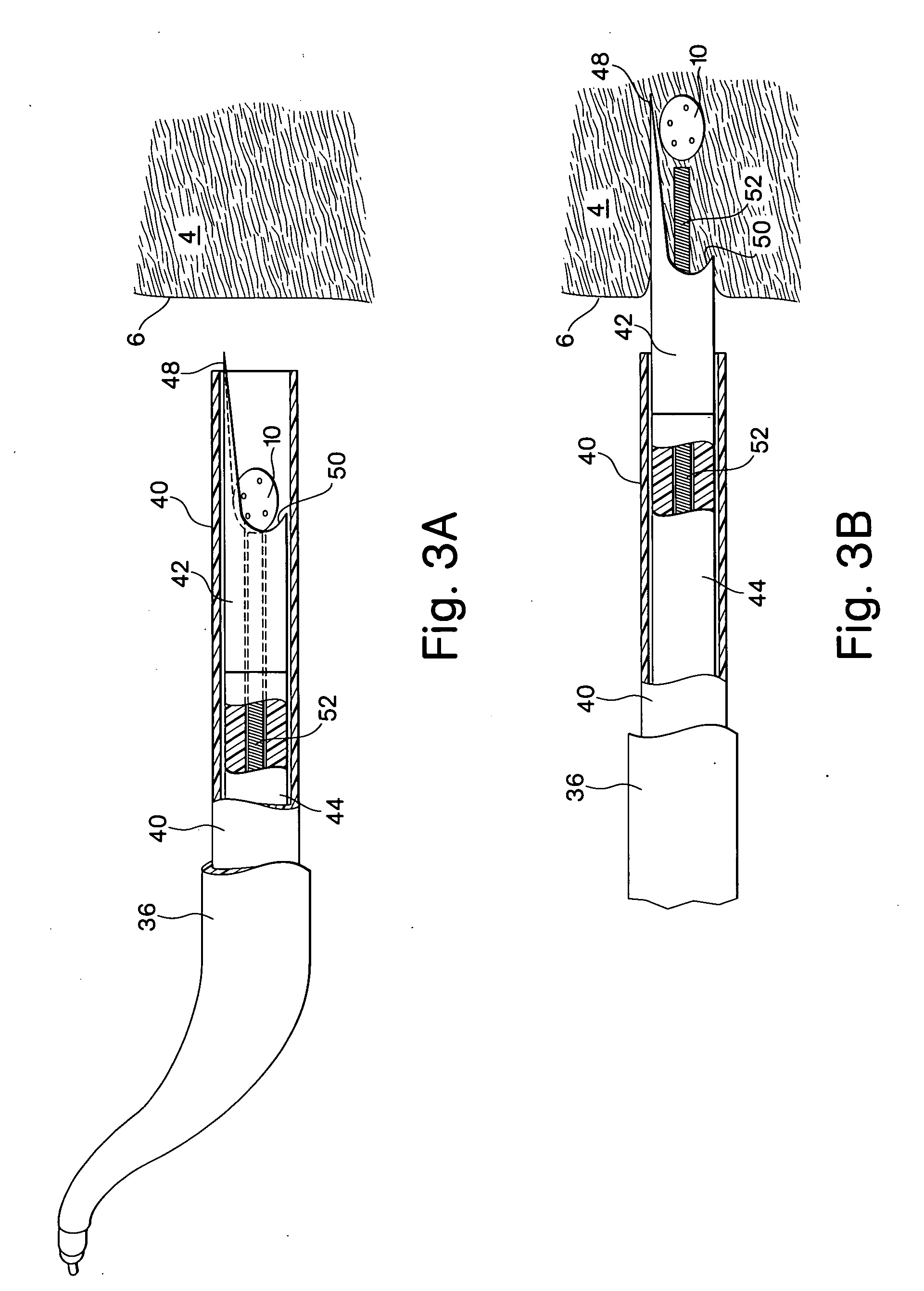 Flexible vascular inducing implants