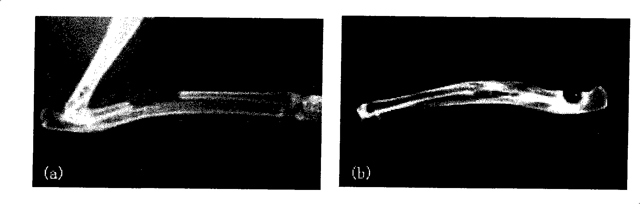 Bone repair material containing nano hydroxylapatite/collagen particle and preparation thereof