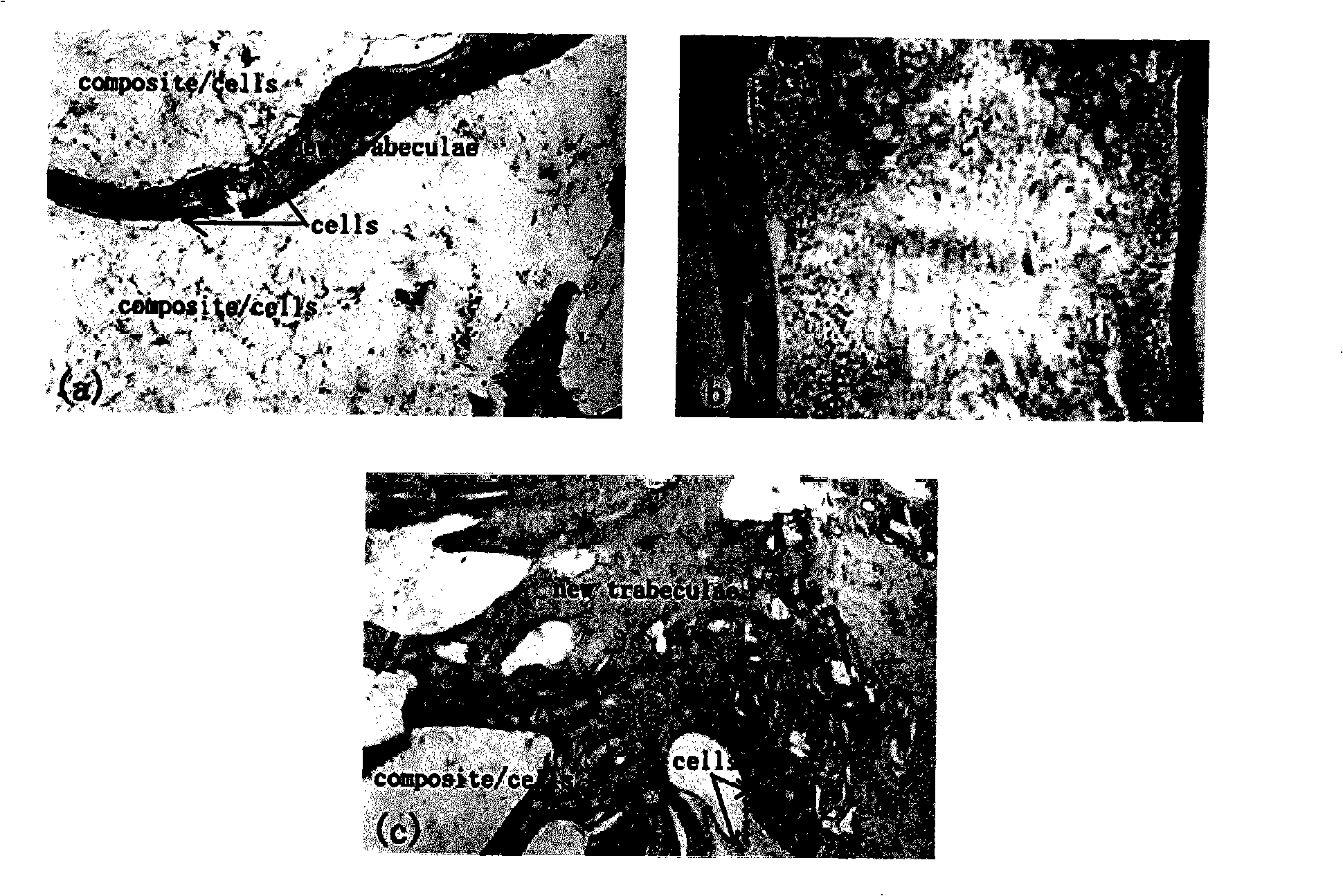 Bone repair material containing nano hydroxylapatite/collagen particle and preparation thereof